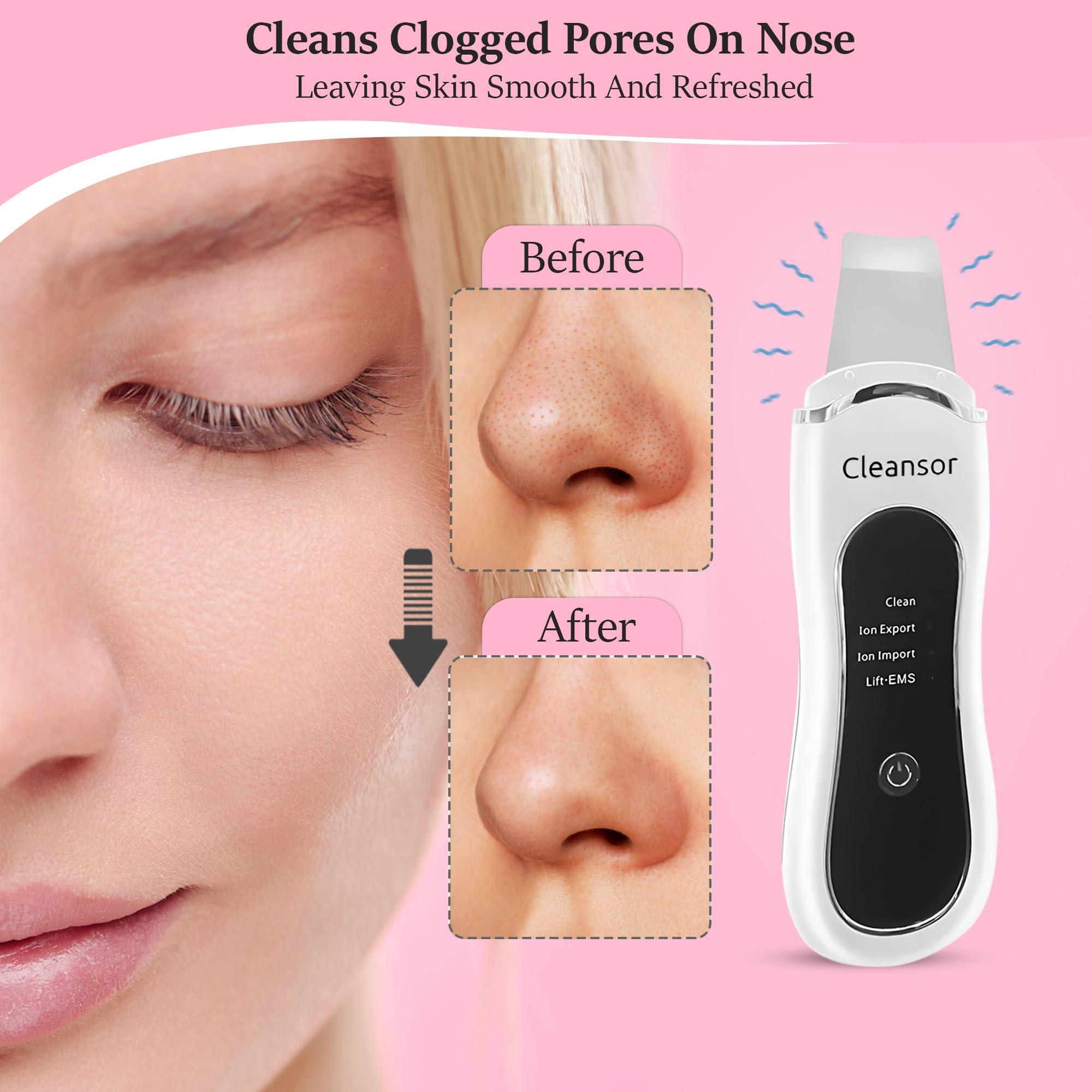 Cleansor Skin Scrubber Pore Cleaner Blackhead Remover Facial Spatula with Clean, Ion and Lift Modes