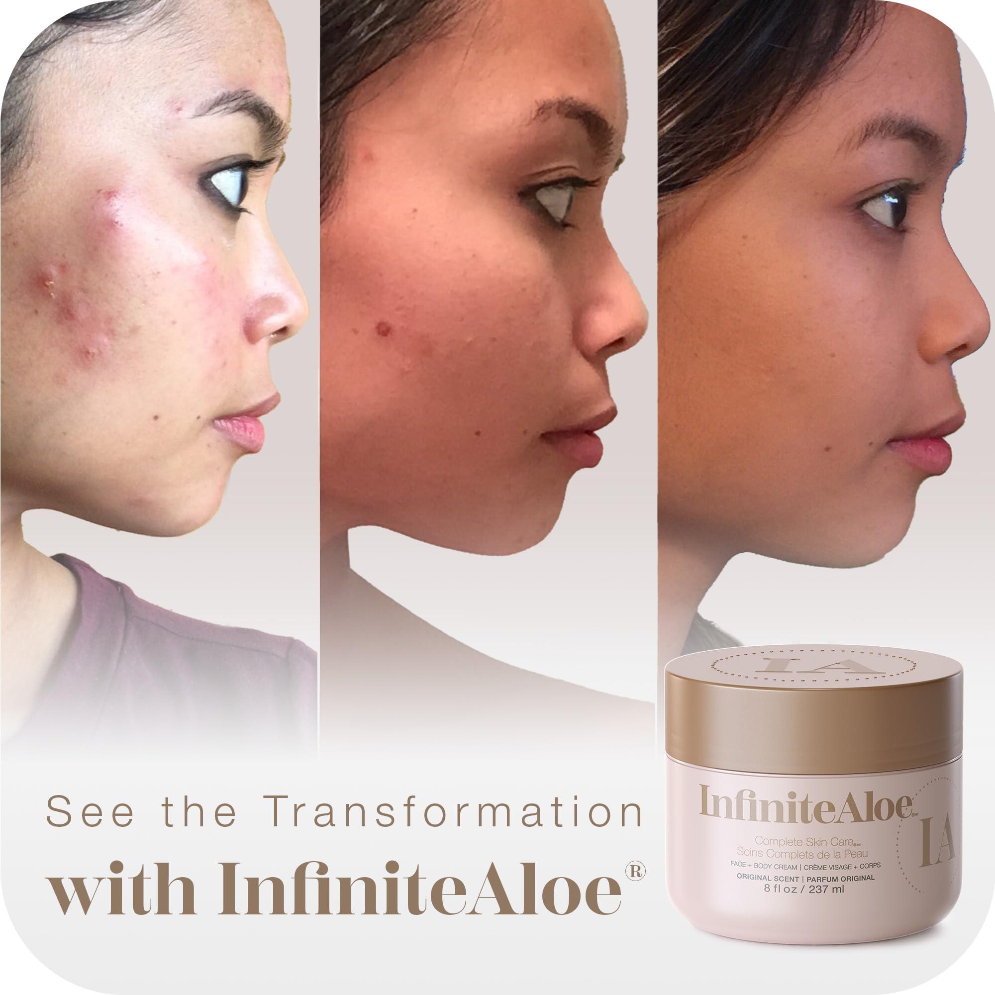 L'Oréal Paris L\'Oreal Paris True Match Super-Blendable Powder Blush, Tender Rose, 0.21 Oz (Packaging May Vary)