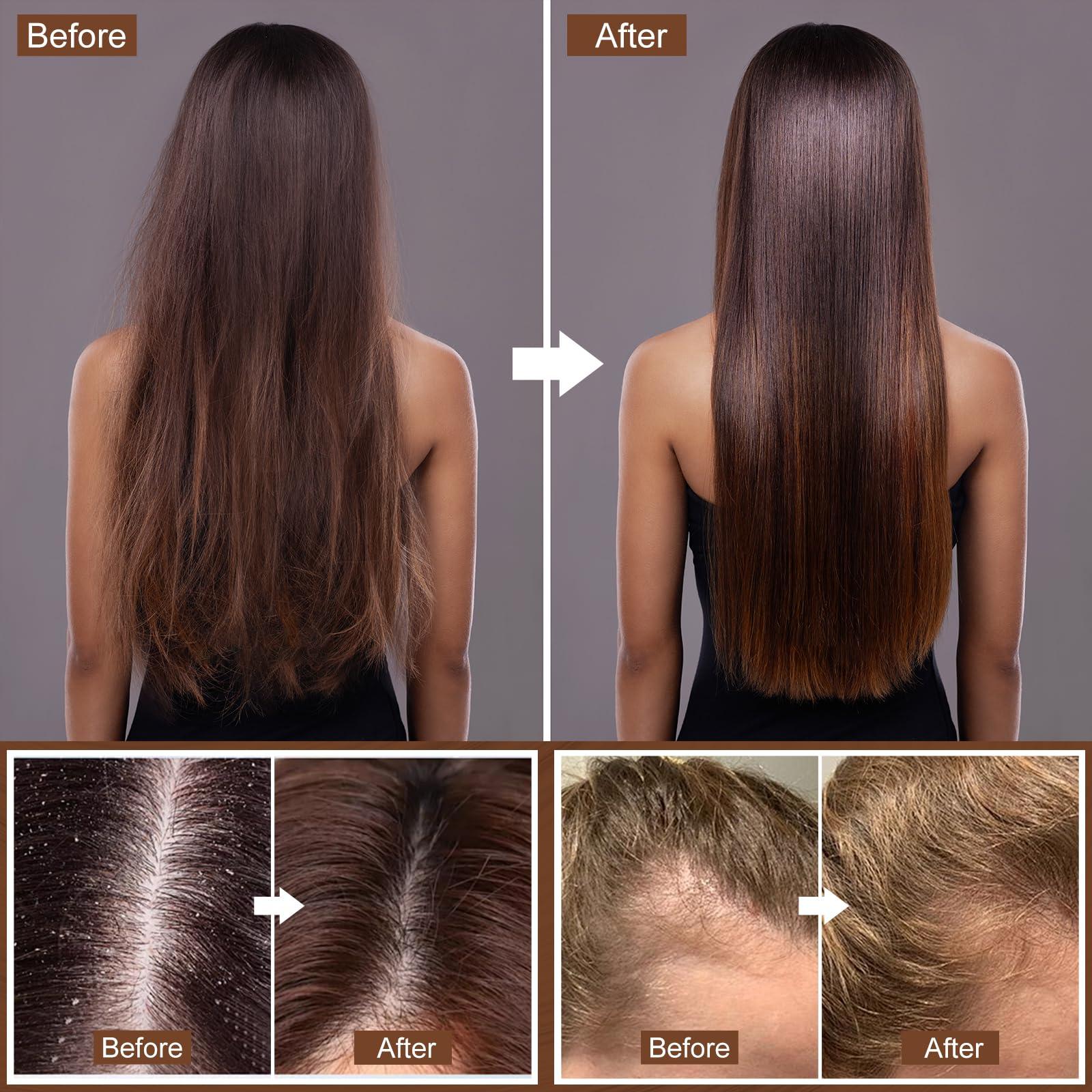 Hotiary Hotiary Ginger Hair Regrowth Shampoo Bar and Conditioner Set, Natural Organic Ginger Shampoo Soap Bar for Hair Growth Anti Hair Loss, PH Balance, 0 Silicone Oil