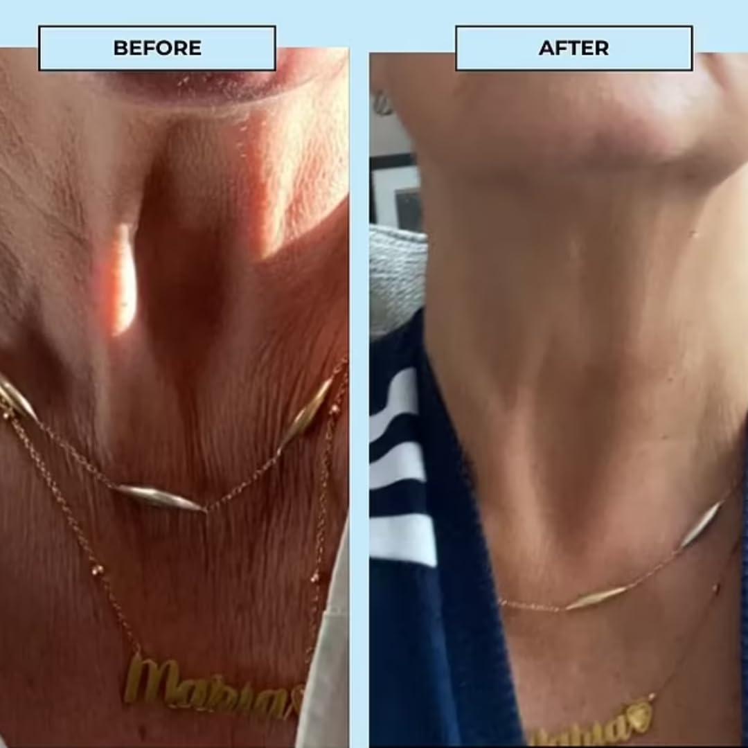 BOOST LAB BOOST LAB Edelweiss Neck Firming Serum - Reduce Neck Wrinkles & Neck Ageing - Lifts & Smooths Crepe-Like, Sagging Skin - Paraben Free, Sulphate Free, Fragrance Free - 30 ml (1 fl oz)