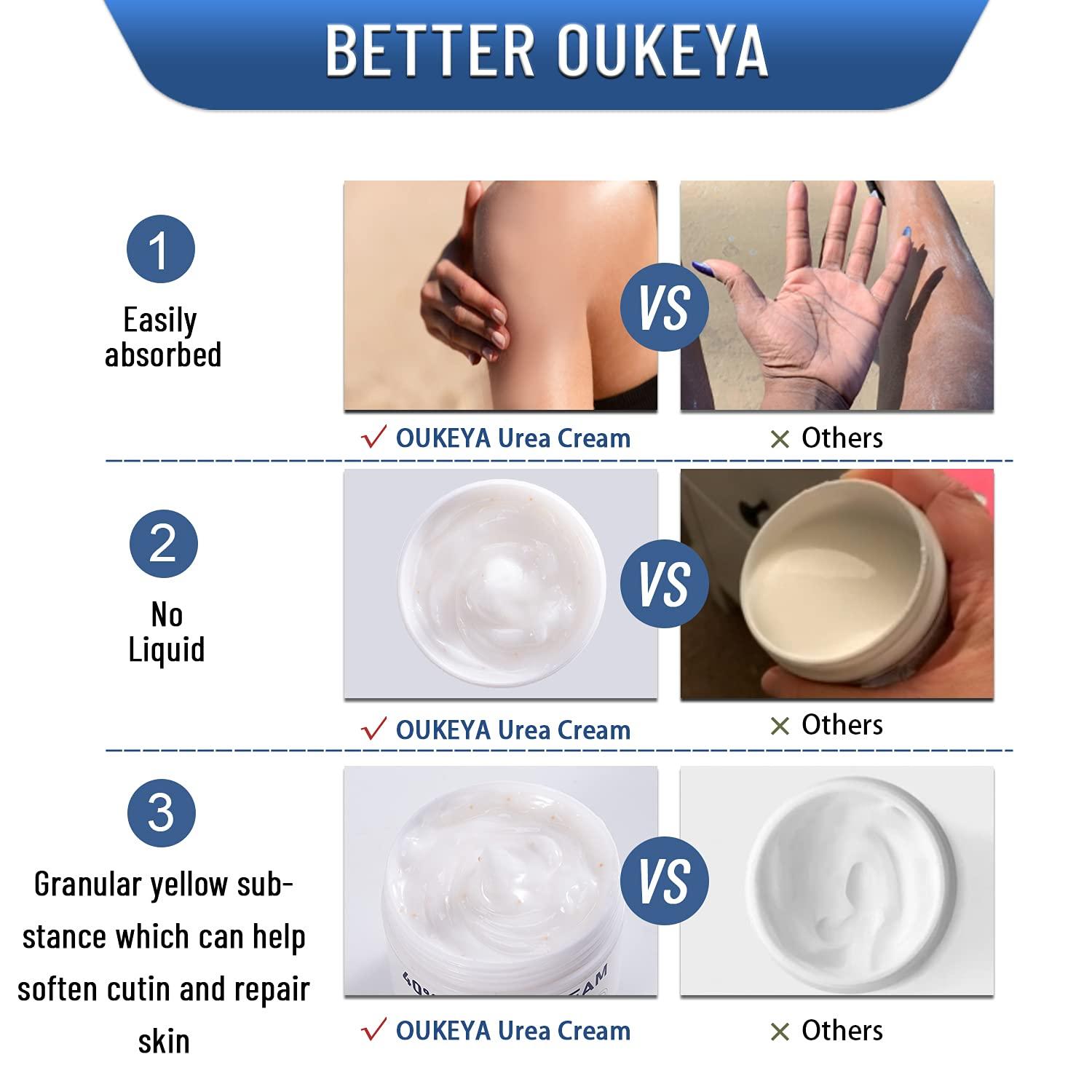 OUKEYA OUKEYA Urea Cream 40 Percent, Urea Foot Cream for Dry Cracked, 40 per Urea Lotion for Feet Maximum Strength (2 Packs)