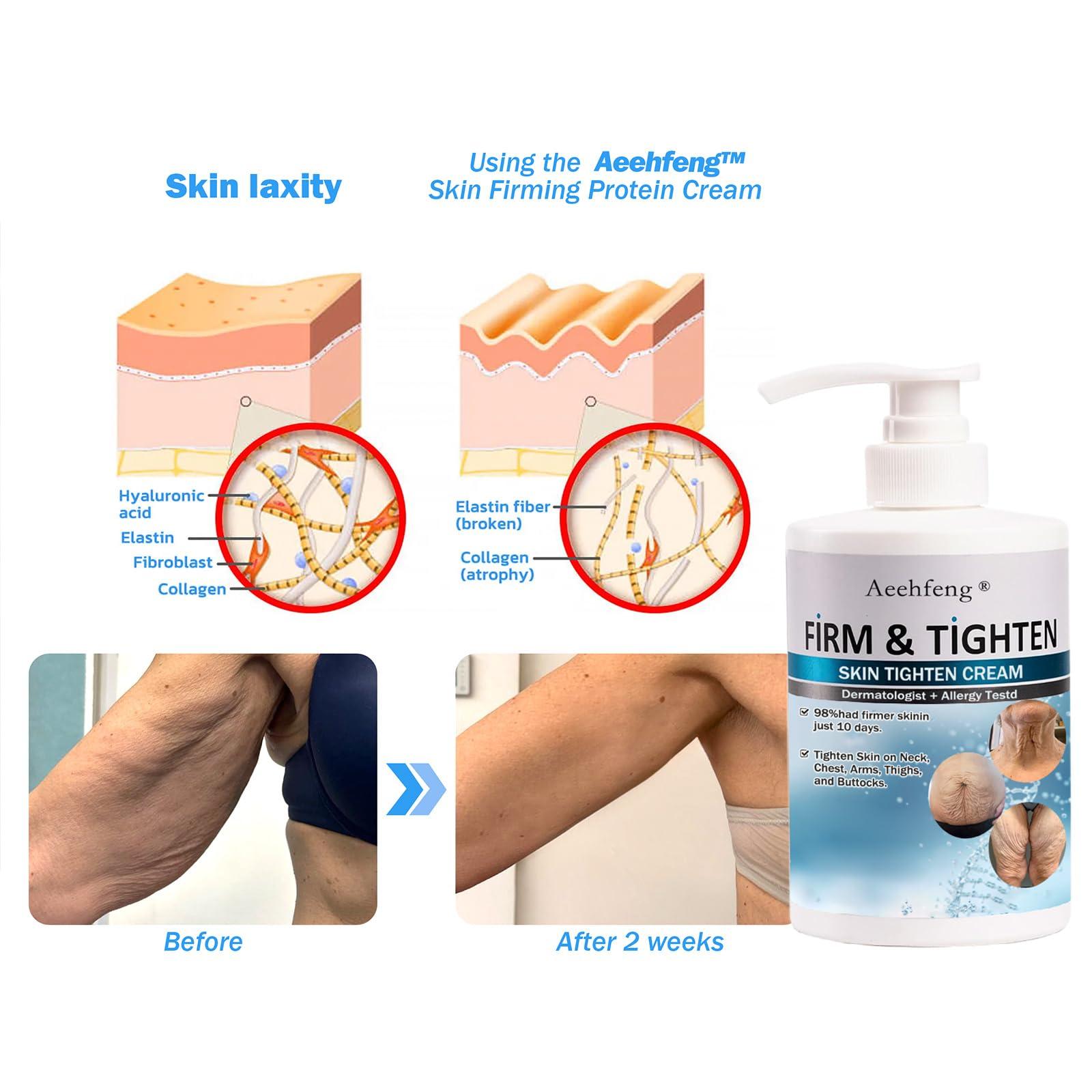 AEEHFENG Aeehfeng Firm Tighten Skin Tighten Cream,Anti-Aging Neck and Dcollet Day&Night Body Cream,Collagen Cream Face Lotion & Body Lotion,Moisturizing,Lifting&Recovery for All Skin Type (3Bottles, 3.47 oz)