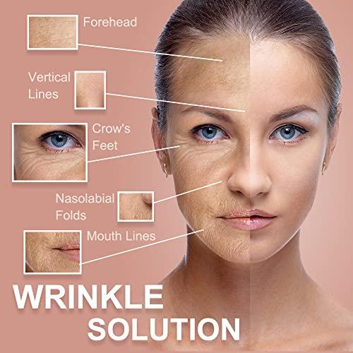 Akissos Akissos Forehead and Between Eyes Wrinkle Patches The Original Wrinkle Patch Non Invasive Wrinkle Smoothers for Forehead Wrinkles 5cm*5m 1 Roll…