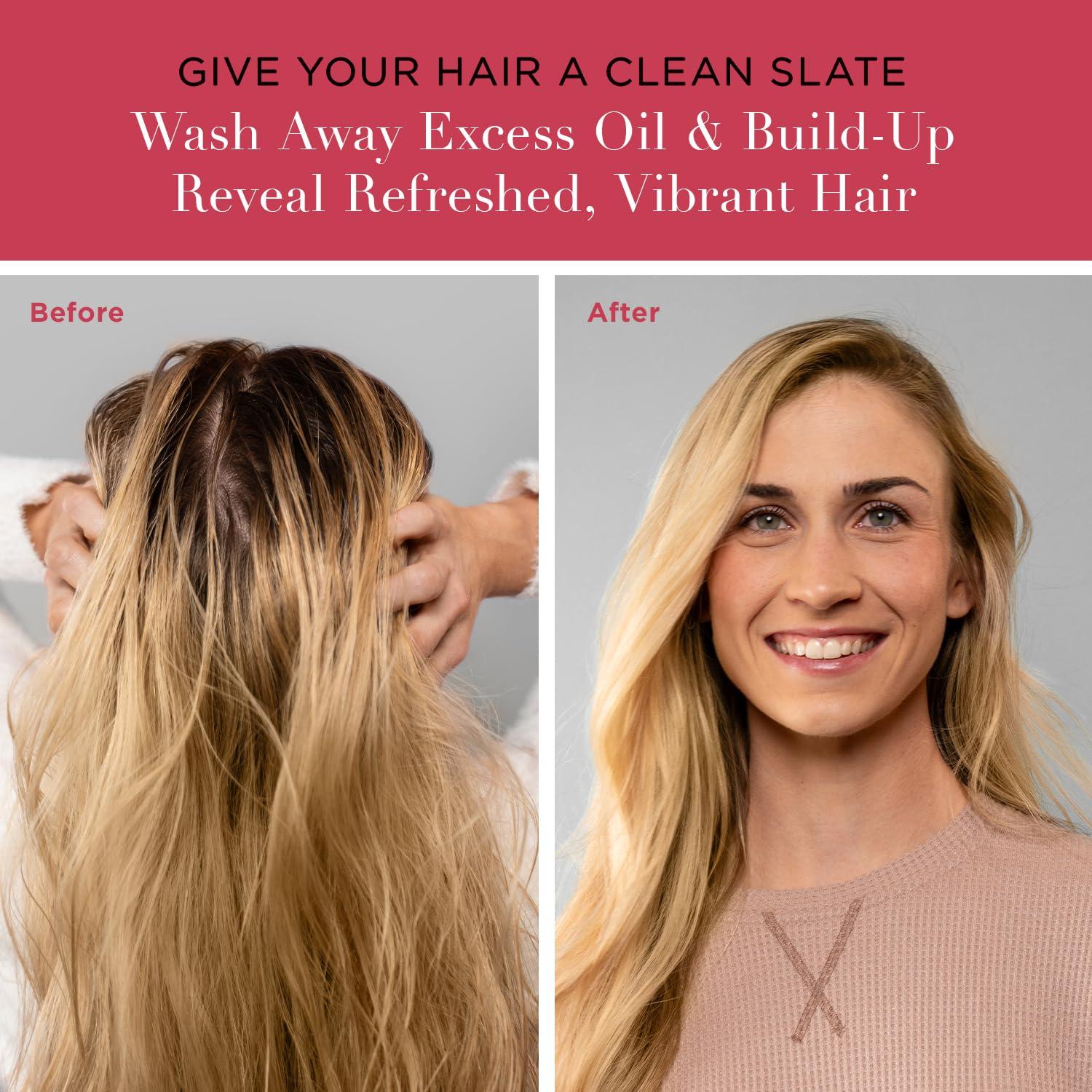 unwash Unwash Anti-Residue Cleanse - Gentle, Ph-Balanced Clarifying Shampoo for Build Up Dirt and Oil, Safe for All Hair Types, 10 fl oz