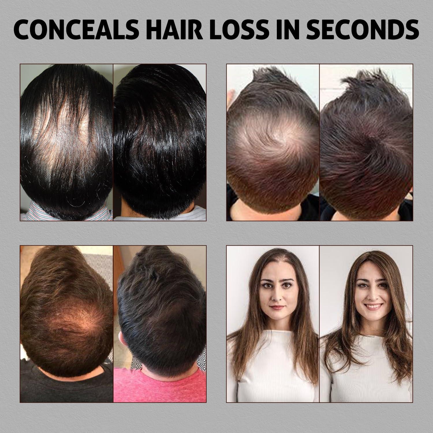 USTAR Ustar 4 in 1 Hair Building Fibers Set for Thinning Hair Thickening Natural Hair Loss Concealer Powder for Men & Women Bald Spot Cover Up and Hair Volume Enhancer 27.5g Light Blonde