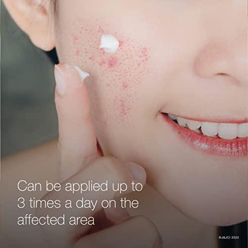 Neutrogena Neutrogena Rapid Clear Stubborn Acne Spot Treatment Gel with Maximum Strength 10% Benzoyl Peroxide Acne Treatment Medication, Pimple Cream for Acne Prone Skin Care, 1 oz