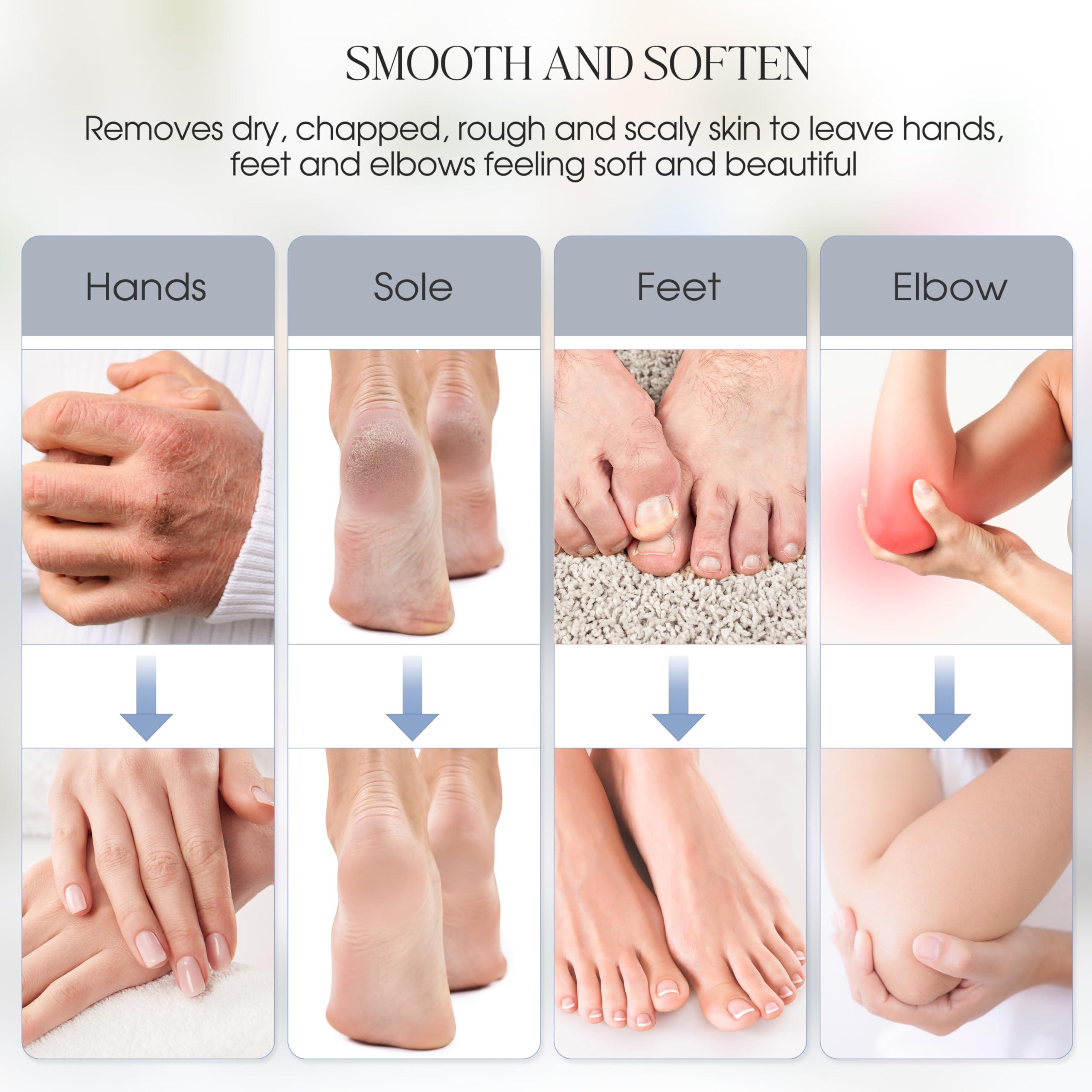 Achzzy Achzzy Paraffin Wax Machine for Hands and Feet, 4000ml Paraffin Bath, Paraffin Wax Warmer with Refills, Nourishing and Moisturizing, Professional-Grade Spa Treatment for Soft and Smooth Skin