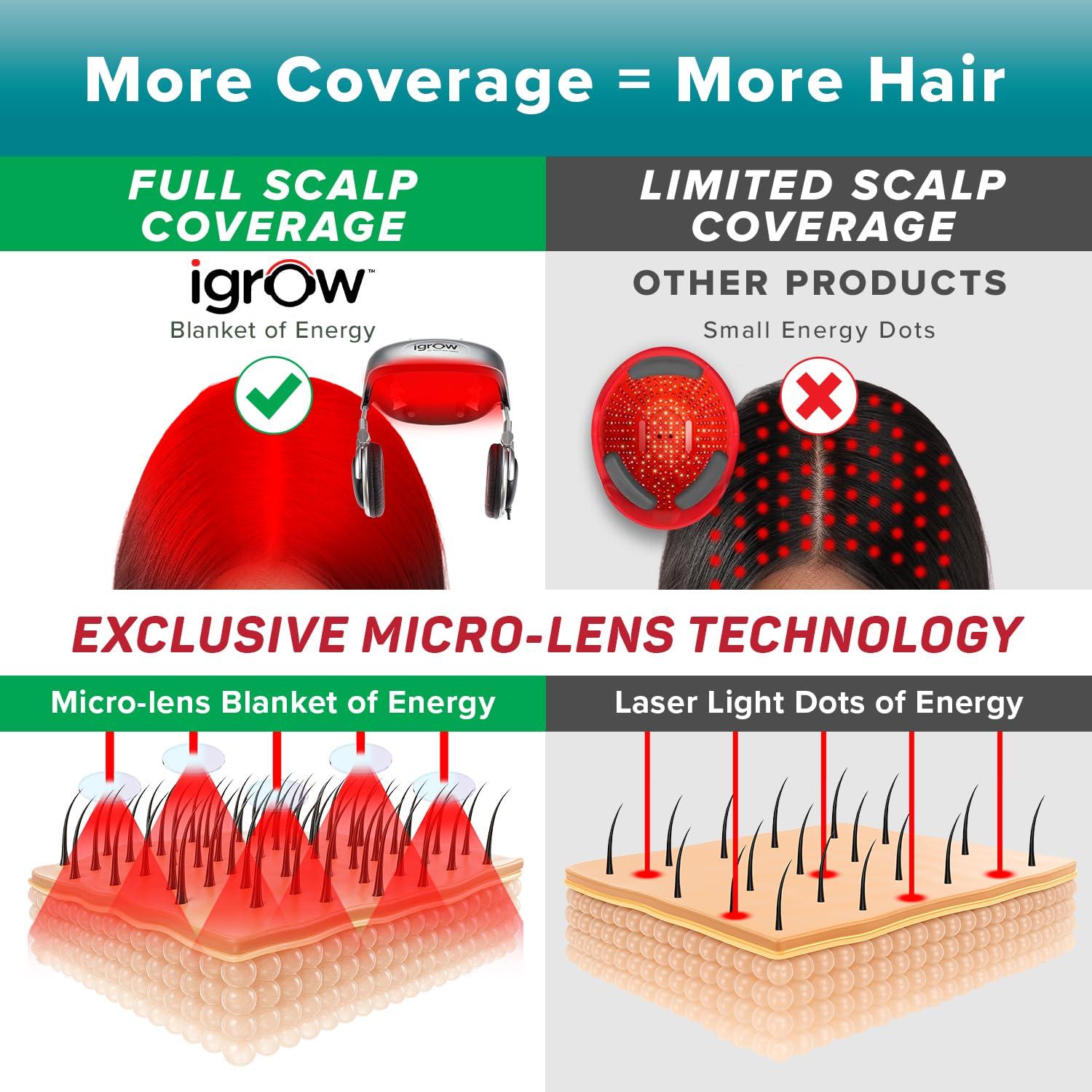 iGrow iGrow Laser Hair Growth System - Clinically proven, FDA Cleared Laser Cap Hair Growth for Men & Women.