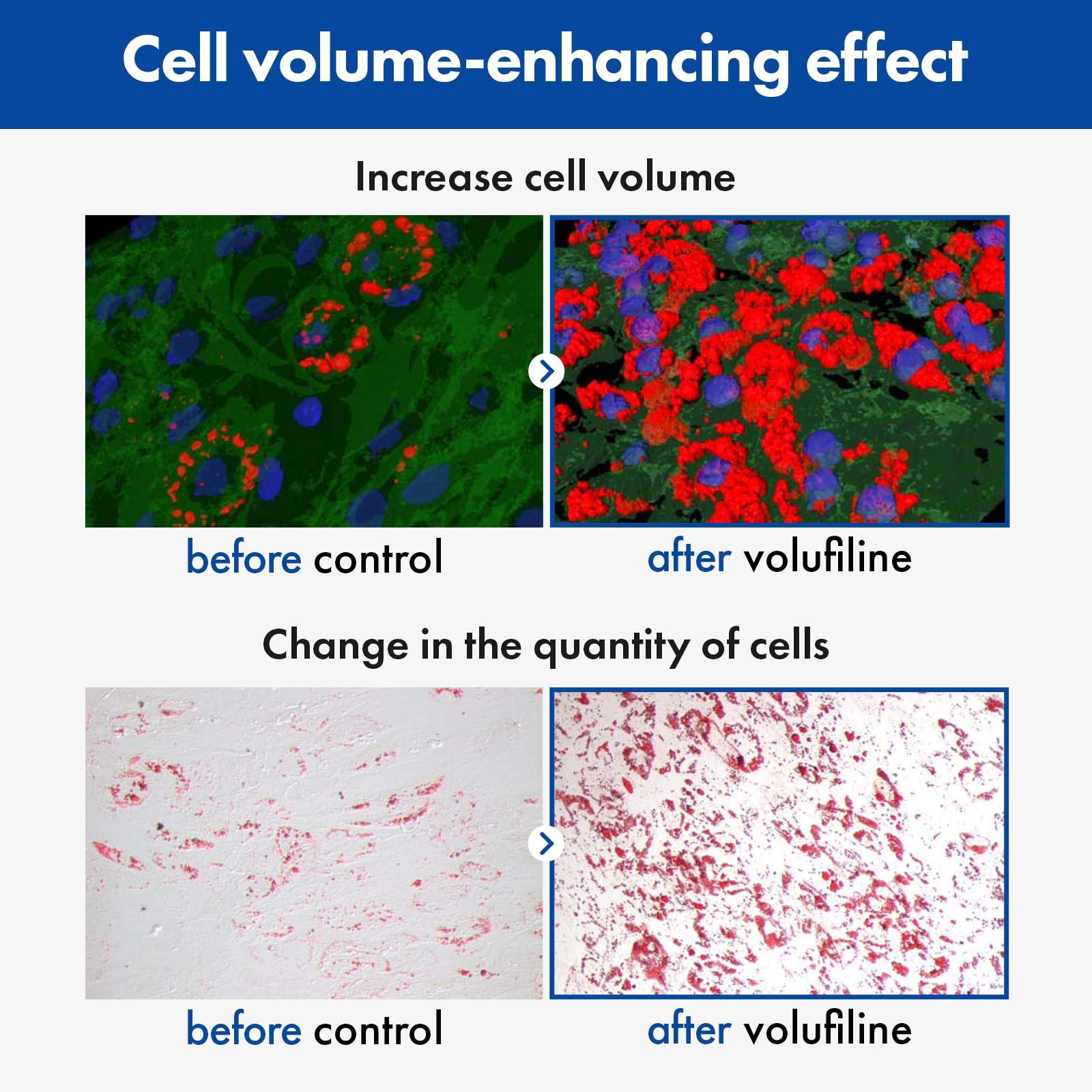 TOSOWOONG TOSOWOONG Volufiline Serum, 100% France Sederma Volufiline Concentrate for Plumping, Skin firming, Boost and Glass skin, glow Skincare for Face, lip and body, 11ml 0.37 fl. oz.