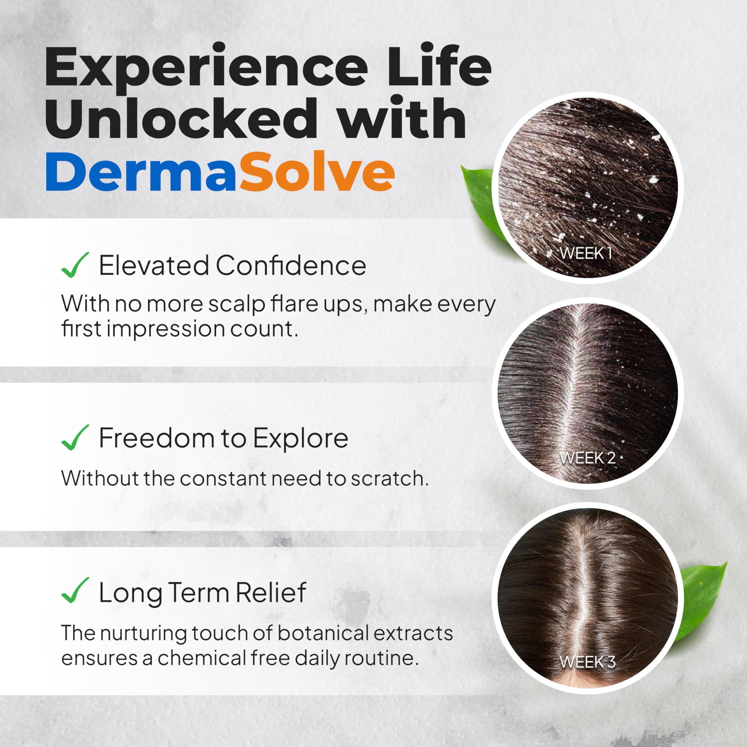 Dermasolve DermaSolve Scalp Psoriasis & Dandruff free Medicated Shampoo with Conditioner, Ultimate Seborrheic Dermatitis Treatment for Itchy, Flakey Scalp, Soothing & Moisturizing Relief