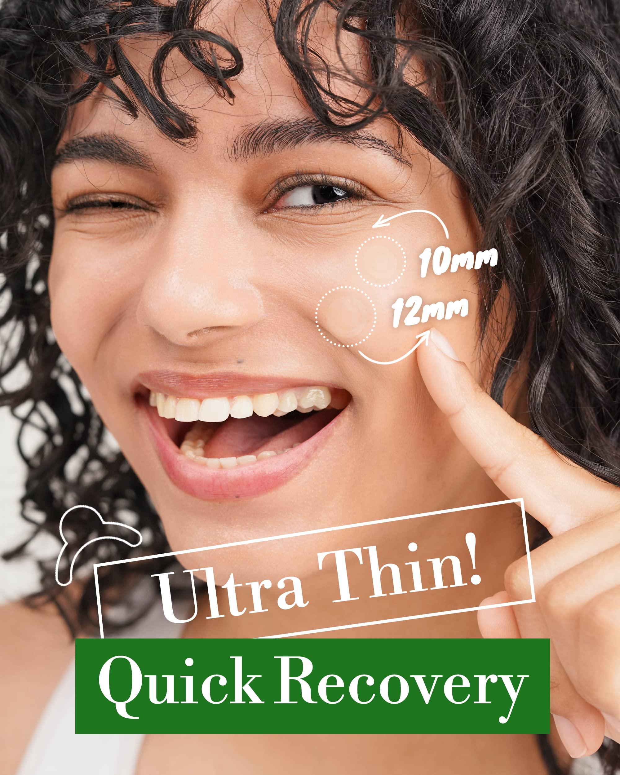 Troubless Troubless Invisible Pimple Spot Patch - Classic, Hydrocolloid Acne Patches for Face | Ultra Thin Acne Patches with Easy Peel Handle | Overnight Pimple Patches | 2 Sizes, 96 Count (Pack of 1)