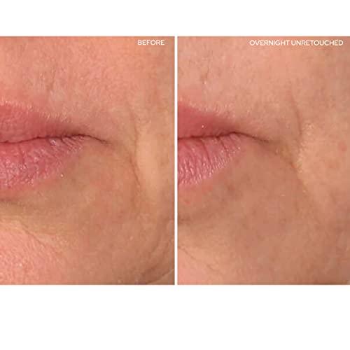 SiO SiO Beauty Eye and Smile SuperLift - Eye & Lip Anti-Wrinkle Silicone Patches - Reduce Smile and Under Eye Wrinkles Overnight