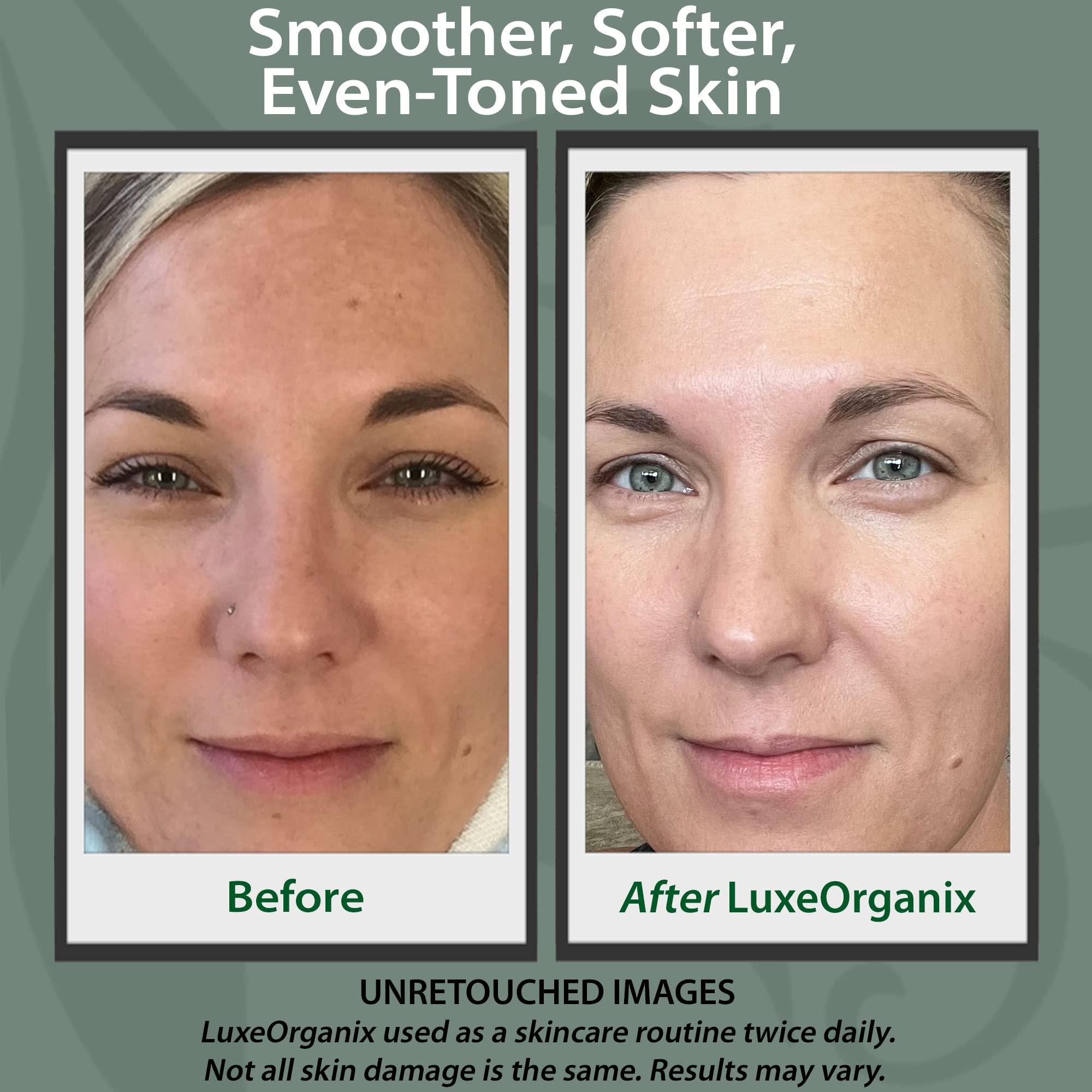 LuxeOrganix LuxeOrganix Organic Vitamin C Face Moisturizer with Anti-Aging, Brightening, and Wrinkle-Smoothing Properties.