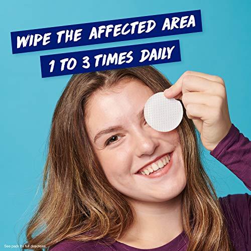 Clearasil Clearasil Ultra 5 in 1 Acne Face Wash Pads, 90 Count (Pack of 2)