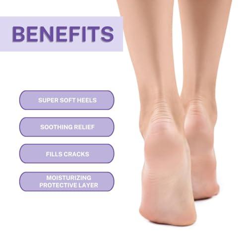 Onyx Professional Onyx Professional Cracked Heel Repair Balm Stick (2 Pack) Dry Cracked Feet Treatment, Moisturizing Heel Balm Rolls On So No Mess Like Foot Cream or Foot Lotion, Rescues Cracked Feet, Lavender Scent