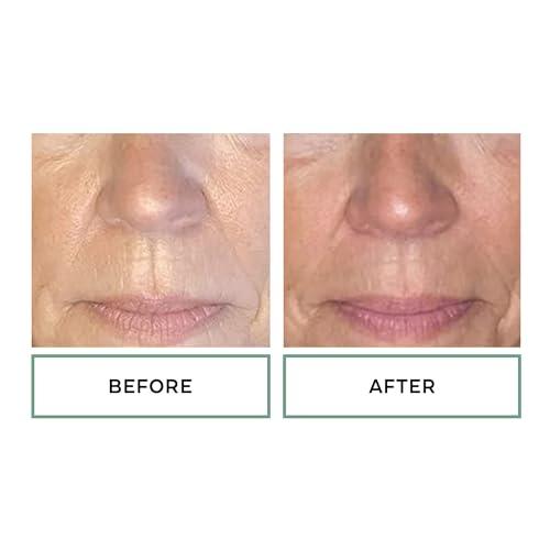 Replenix Replenix Anti-Aging Retinol 5X Regenerate Dry Serum, Medical-Grade Quick-Drying Face Serum for Mature Skin (1 fl. oz)