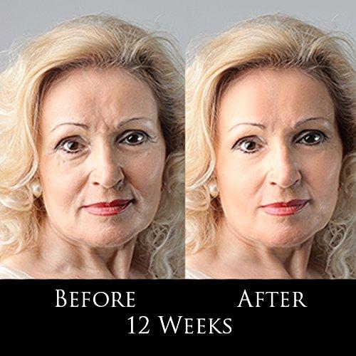 TRSDIANA TRSDIANA DMAE Anti-Aging Moisturizer - Premium Anti-Aging, for Face and Neck, Moisturizes, perfect for Oily, Dry, and Sensitive Skin, Natural Blend of Vitamin E, Caviar, Aloe, Green Tea Antioxidant,