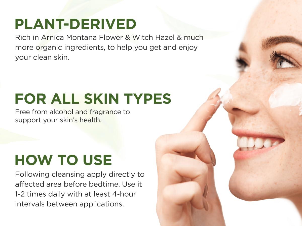 WELLUTION Wellution Cystic Acne Treatment Cream - Natural Pimple and Scar Remover with Tea Tree Oil - Effective Overnight Face Treatment for Acne Spots, Pimples and Scars - 1oz