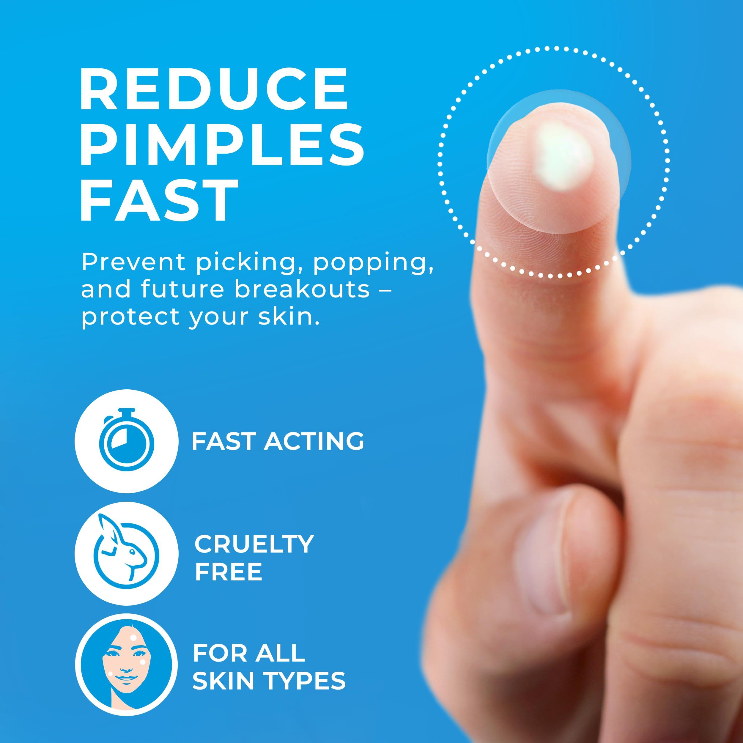 KEYCONCEPTS PatchRx Pimple Patches for Face (120 Patches), Hydrocolloid Acne Patches with Tea Tree Oil, Pimple Patch Pimple Stickers - Hydrocolloid Patch Acne Dots - Acne Pimple Patches For Face - Zit Patches