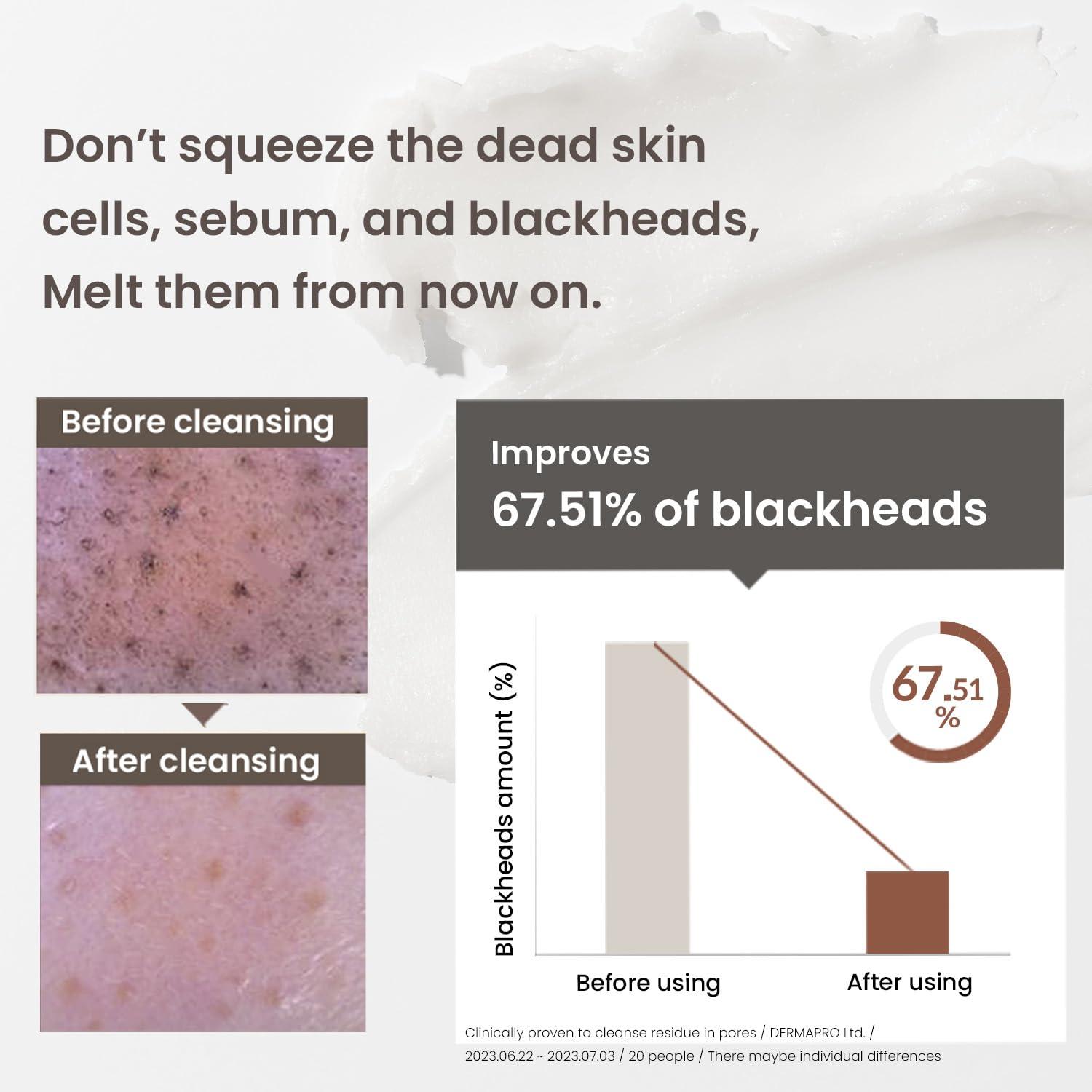 HEIMISH HEIMISH All Clean Balm 4.0fl.oz/120ml - Multi-Purpose Cleansing Balm | Makeup Remover, Face Wash, Pore Care, Blackhead Care, Moisturizer | Natural Aroma Oil, Balm-to-Oil Formula | Korean Skincare