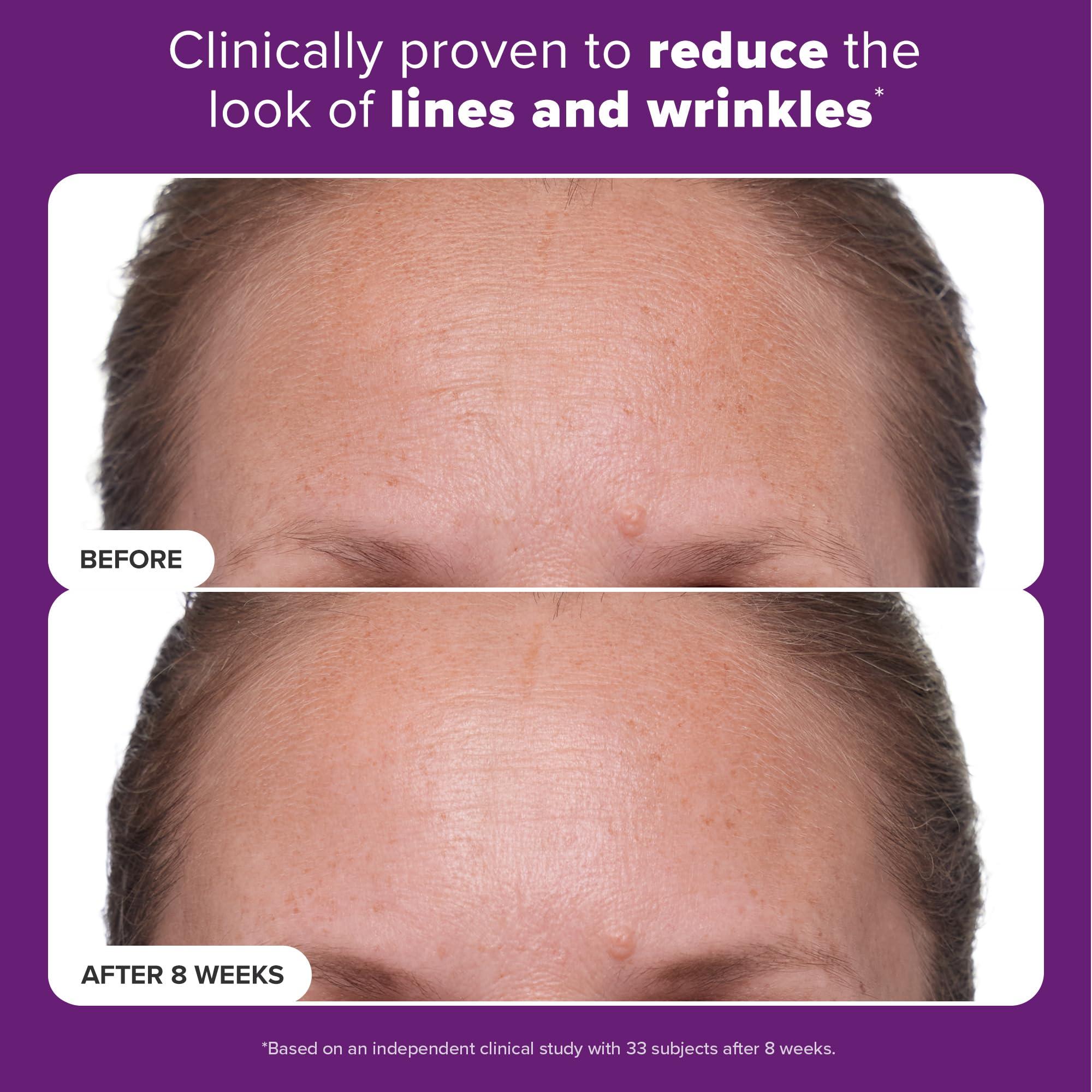 Paula's Choice Paula's Choice CLINICAL 1% Retinol Treatment Cream with Peptides, Vitamin C & Licorice Extract, Anti-Aging & Wrinkles, Travel Size. PACKAGING MAY VARY.