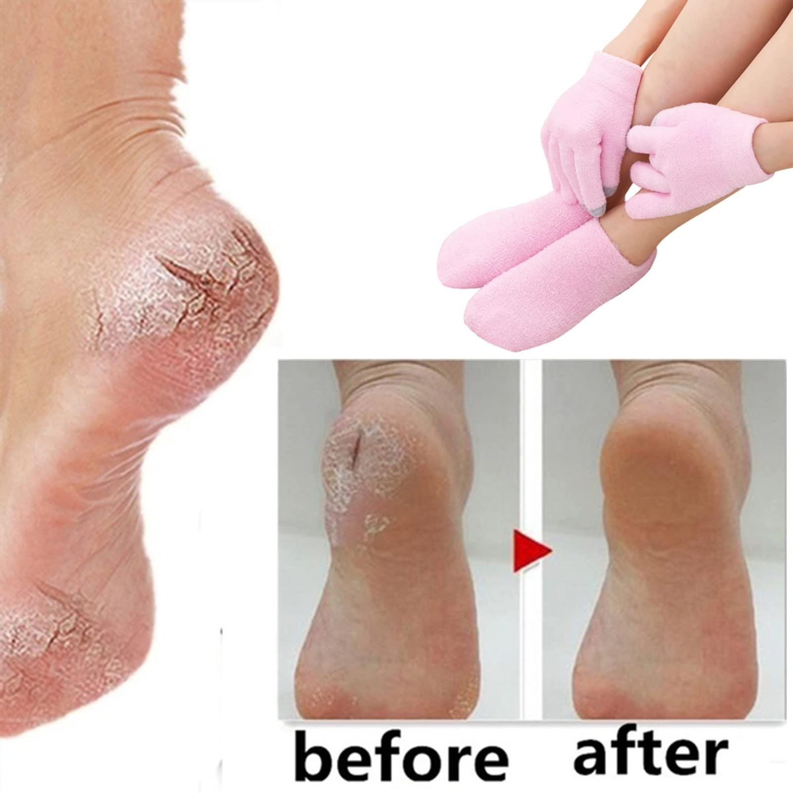 D-GROEE Moisturizing Gloves Reusable Touch Screen Gloves Dry Hands Treatment Healing Gloves Hydrating Cracked Hand Repair Rough, Chapped Skin Overnight Green B