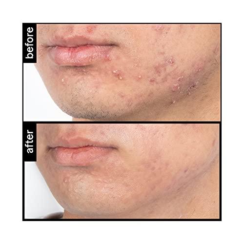 pH-In pH-In The Cleanser