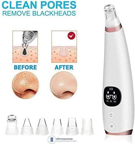yigeren Qin Black Head Suctioner,Blackhead Remover Vacuum,Blackhead Remover Pore Vacuum - Electric Pore Cleaner, Blackhead Extractor Tool for Women and Men,USB Rechargeable LCD Display