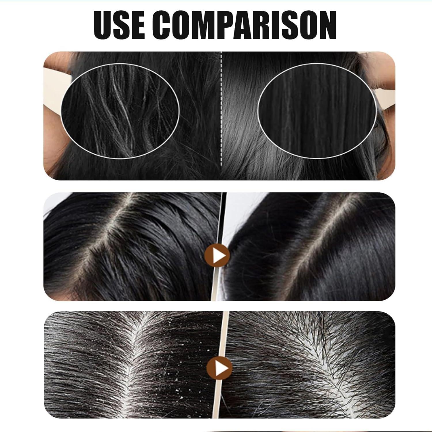 BACIOKIS Rice Fermentation Essence Hair Cream,Fermented Rice Water Hair Mask, Rice Hair Mask,Deep Conditioning Hair Mask Rice Water (1pc)