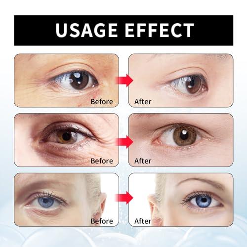Berbax Generic Berbax Eye Cream - Instant Tightening Eyelid Firming Cream for Anti-Aging Fine Lines & Under Eye Tightening