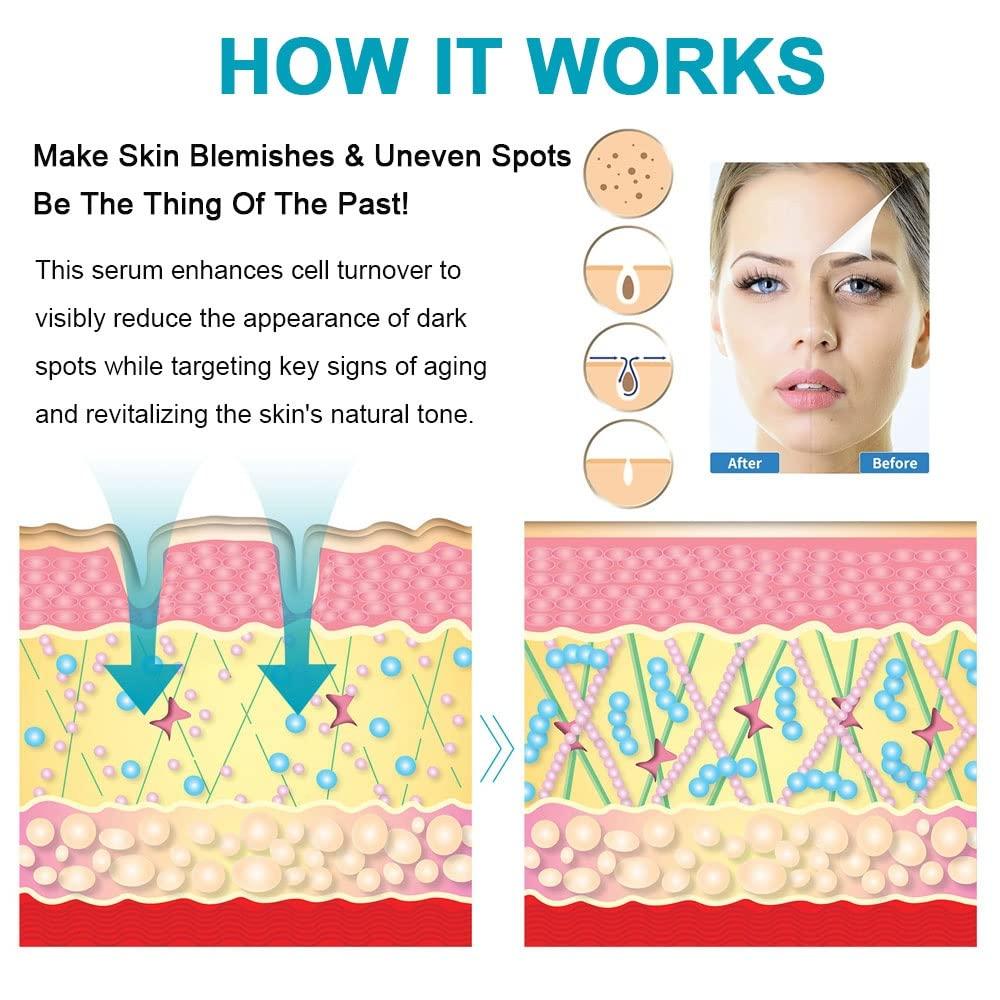 SWETIYOU Dark Spot Remover for Face, Fast-Acting Dark Spot Corrector Remover for Face and body Hyperpigmentation, Fades Melasma, Freckle, Sun Spots, Evens Skin Tone, Age Spot Remover for Women Men