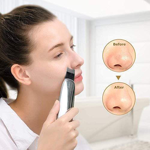 TOUCHBeauty TOUCHBeauty Professional Facial Scrubber Spatula Cordless Blackheads Remover Comedones Extractor Rechargeable Skin Scraper Device -Won Red Dot Winner 2021