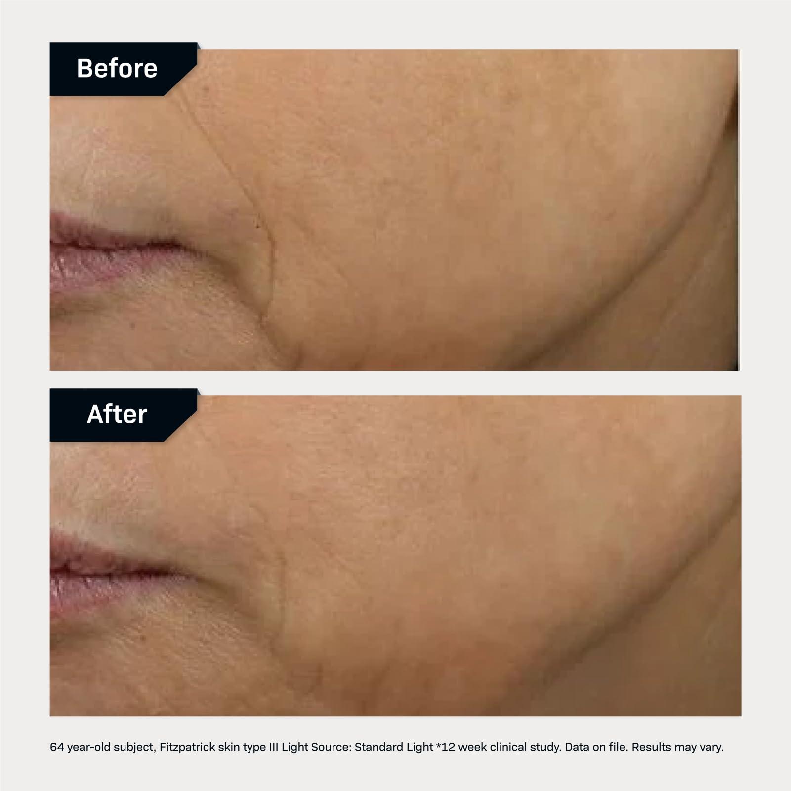 Revision Skincare Revision Skincare DEJ Face Cream, Advanced Anti Aging Moisturizer, Lifting and Firming, Antioxidant Rich, 0.5 oz