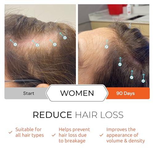 DS LABORATORIES DS Laboratories Revita Shampoo and Conditioner Set, Hair Thickening Shampoo and Conditioner to Support Hair Growth, Sulfate Free Shampoo and Conditioner with Biotin, Caffeine & DHT Blocker, Hair Care