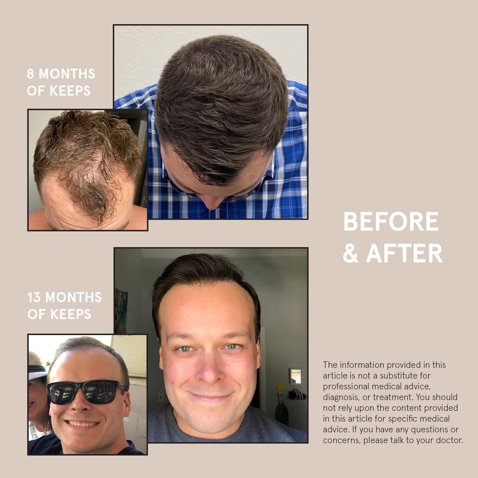 Keeps Keeps Hair Regrowth Treatment Mens Shampoo for Fuller, Thicker Looking Hair, 8 oz - Thinning and Hair Growth Shampoo for Men - DHT Blocker - Infused with Biotin, Caffeine, & Saw Palmetto