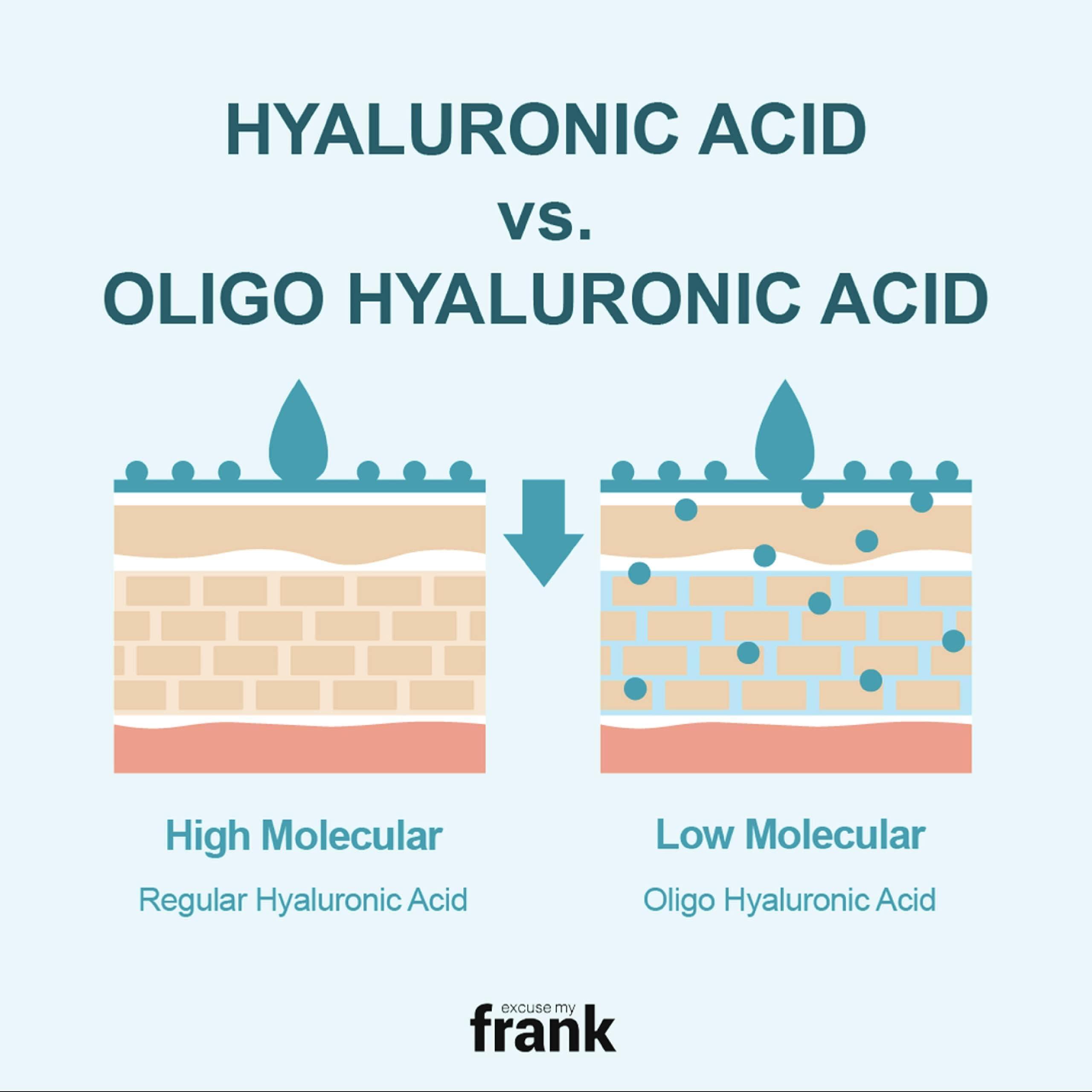 Innerest Innerest [Excuse My Frank Intense Moisturizing Cream Fragrance Free Hyaluronic Facial Creams & Moisturizers 150 g / 5.29 oz I Korean Skincare