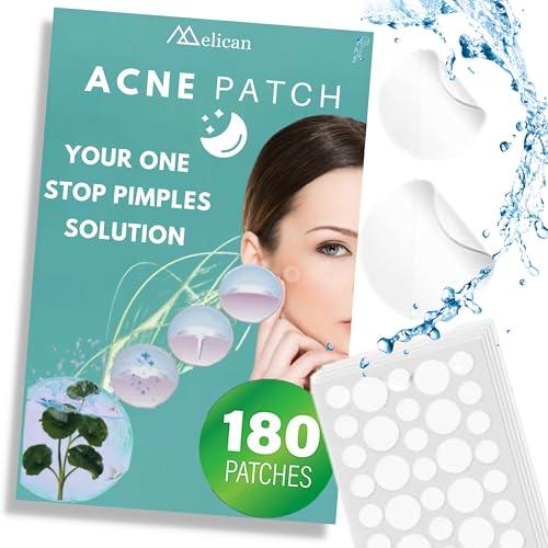 MELICAN MELICAN Pimple Patches for Face 180 Count - Acne Patches for Face - Hydrocolloid Large Zit Patches - 2 Size Pimple Patch 8mm, 12mm