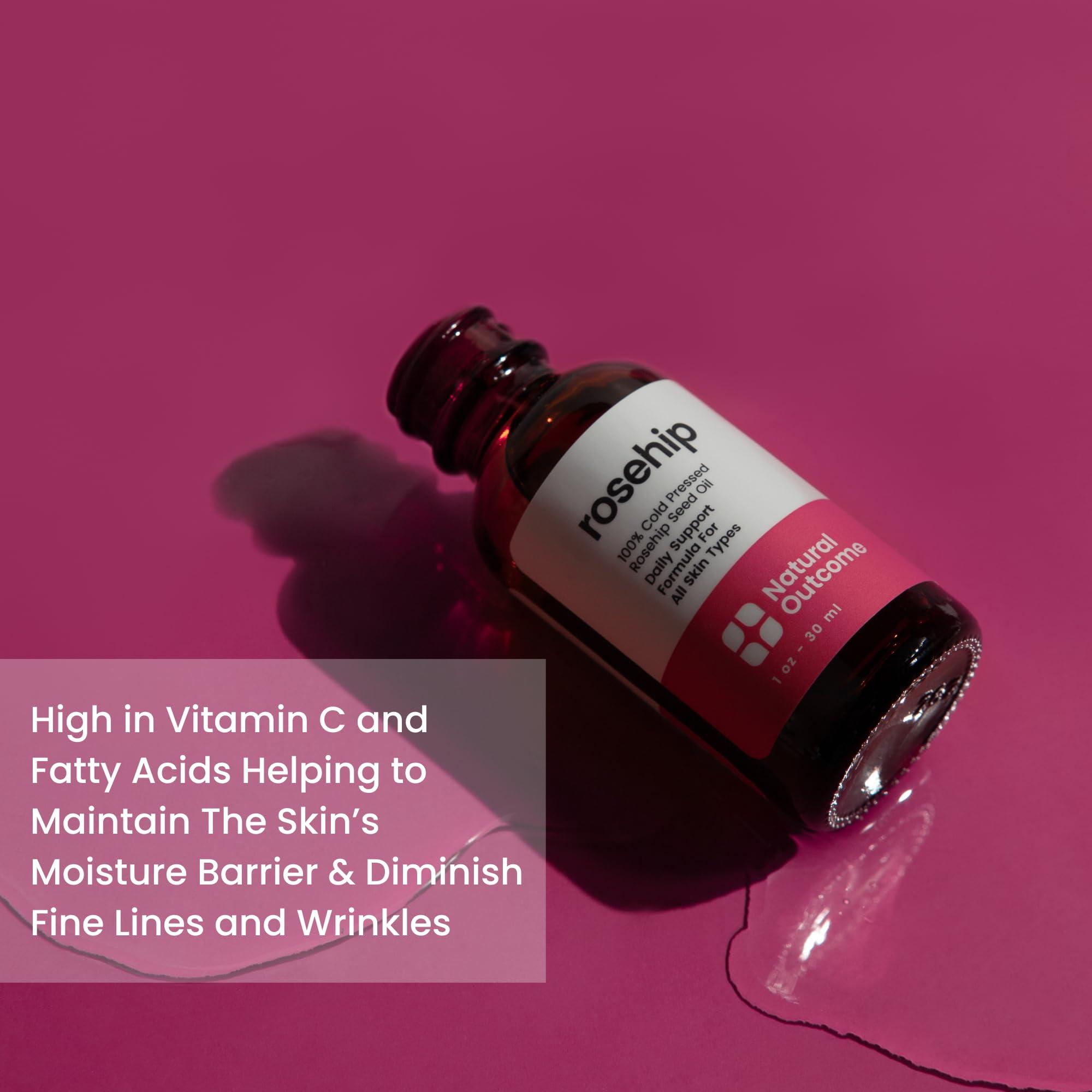natural outcome natural outcome Rosehip Oil 100% Pure Cold-Pressed Rosehip Seed Face Oil - Anti-Aging Facial Oil to Plump, Balance & Hydrate 1 oz
