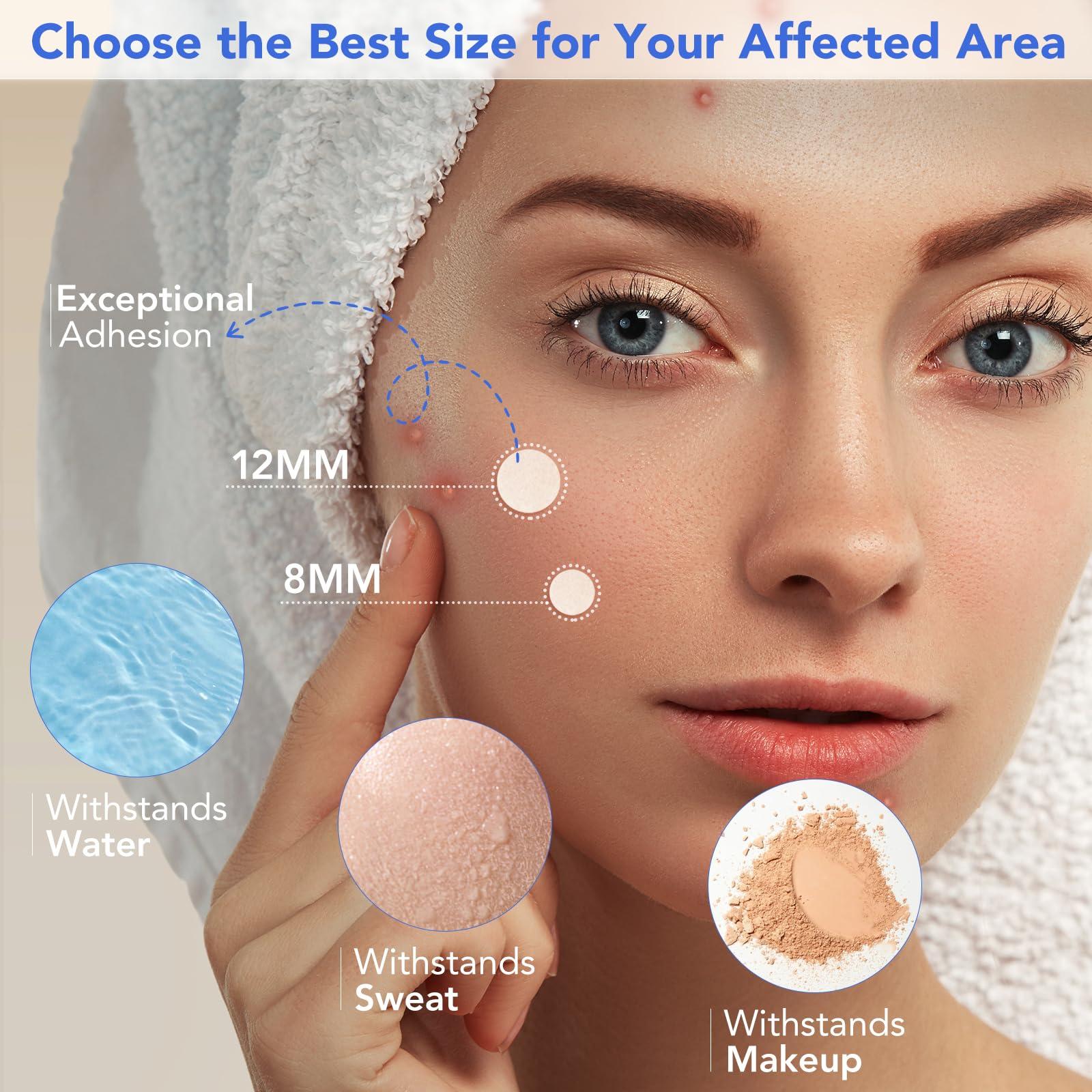 Qmakup Qmakup Pimple Patches for Face,Acne Patches for Face,Pimple Patch,Zit Patches,Hydrocolloid Blemish Patches for Covering Zits and Blemishes,with Salicylic Acid,Tea Tree oil & Calendula oil, 108 Counts