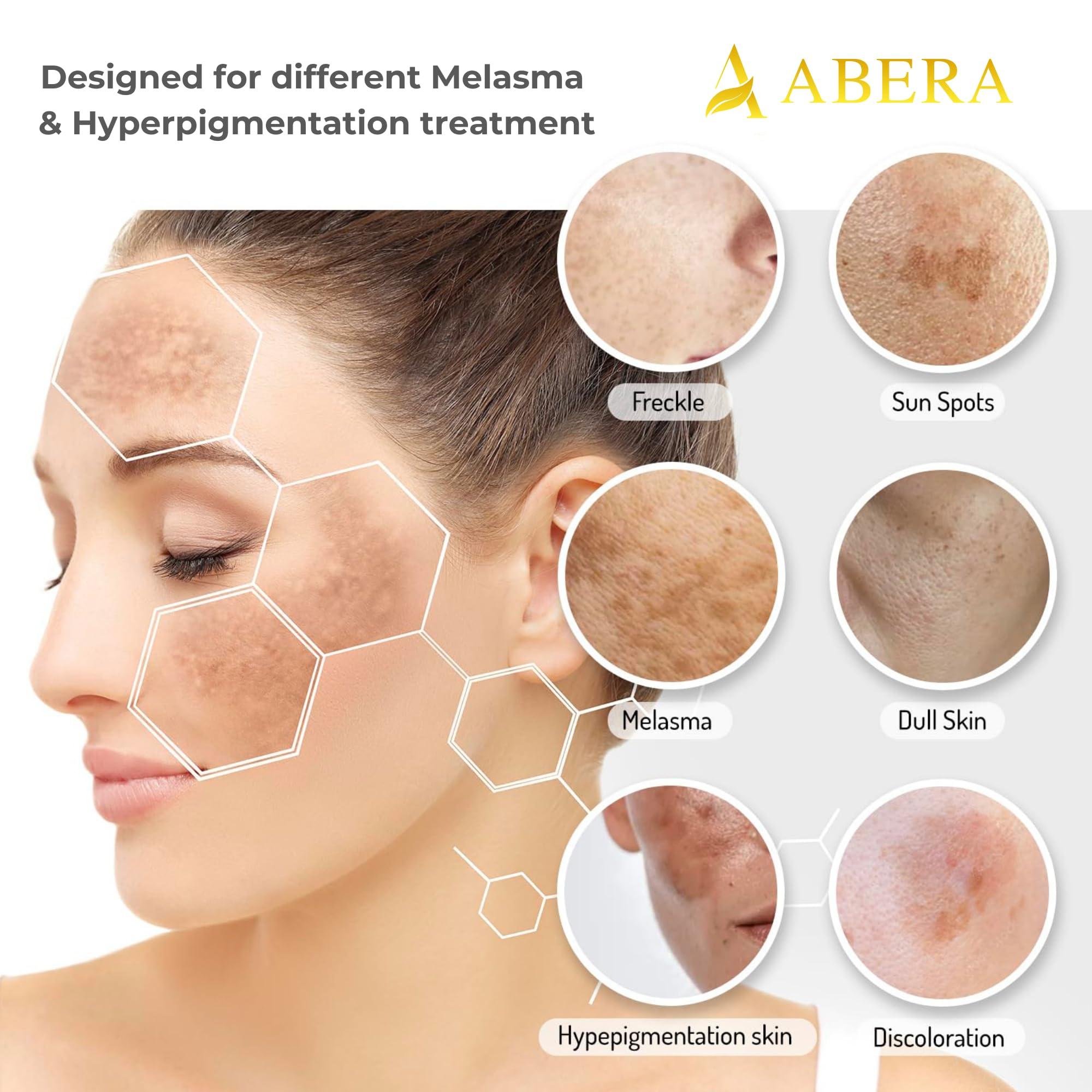 ABERA Abera Combo Melasma Treatment for Face, Melasma Remover Double Effect with Combo Serum and Cream, Abera Melasma Serum with Abera Kasumi Glowing Cream (2 Cream 1 Serum)