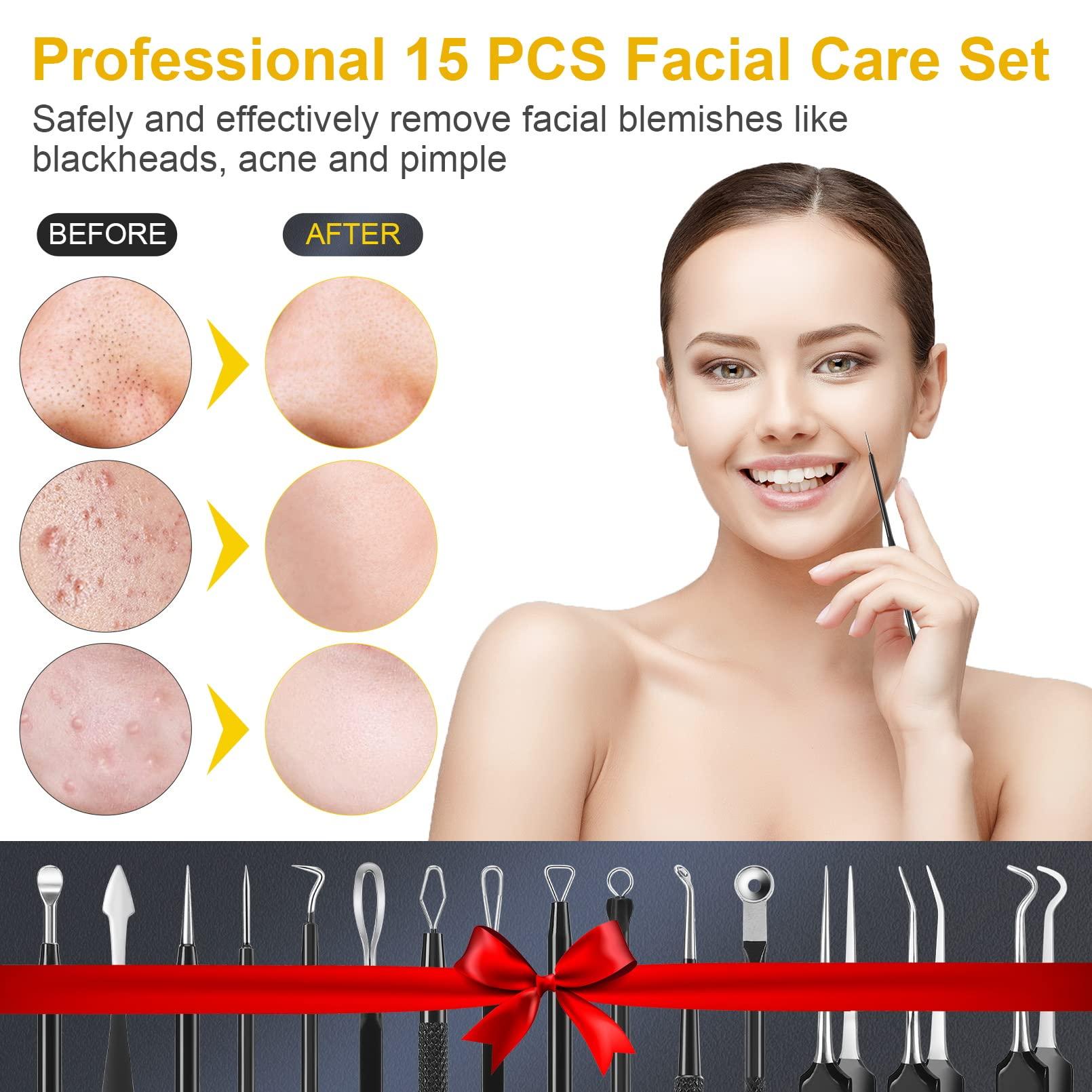 IUMAKEVP Pimple Popper Tool Kit, IUMAKEVP 15 PCS Professional Stainless Steel Blackhead Remover Comedone Extractor Tools for Removing Pimples, Blackheads, Zit on Face - Acne Removal Kit with Metal Case (Black)