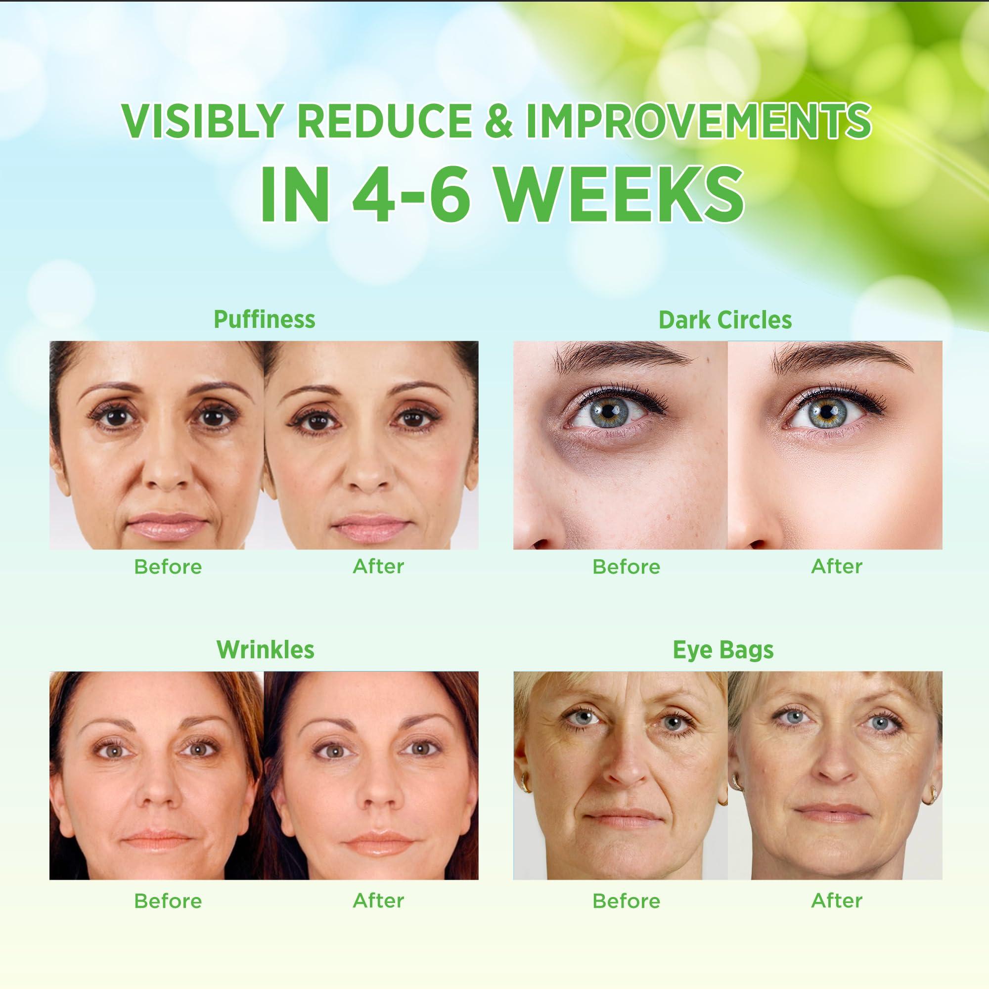 VELAMO ADVANCED VELAMO ADVANCED Under Eye Patches: Aloe Vera Under Eye Mask for Dark Circles - Retinol Eye Patches for Wrinkles and Puffiness - Under Eye Bags Dark Circles Treatment for Women and Men 60 Pcs