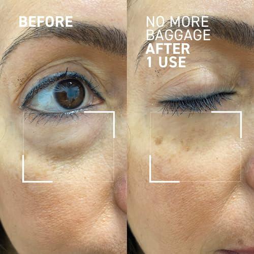 Dr. Brandt Skincare Dr. Brandt Skincare Needles No More Baggage Eye Gel Unisex, Nude, 0.5 Oz