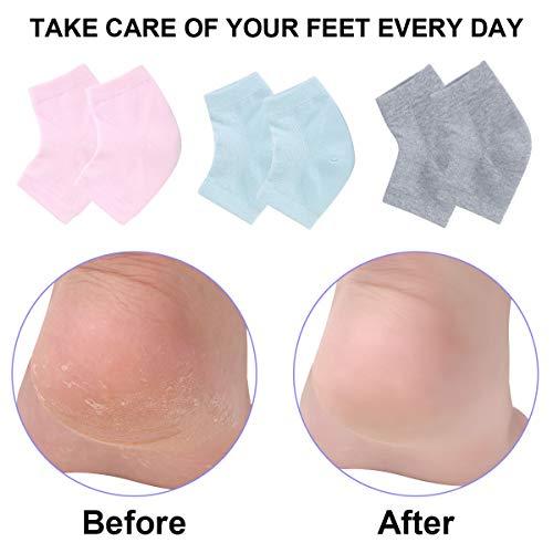 Exptolii Vented Moisturizing Gel Heel Socks, 3 Pairs Toeless Spa Sock for Foot Care Treatment, Cracked Heels, Dry Feet, Foot Calluses (Gray, Green, Pink)
