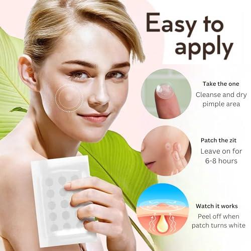 MELICAN MELICAN Pimple Patches for Face 180 Count - Acne Patches for Face - Hydrocolloid Large Zit Patches - 2 Size Pimple Patch 8mm, 12mm