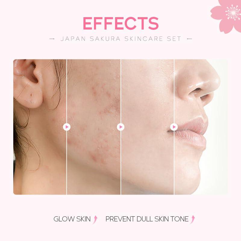 OFOBC Travel Skincare Set for Women and Teens, Facial Skin Care Gift Set with Vitamin C & Cherry Blossom, Gentle Skin Cleaning & Care Set | Cleanser Toner Serum Eye Cream Face Cream (5PCS)