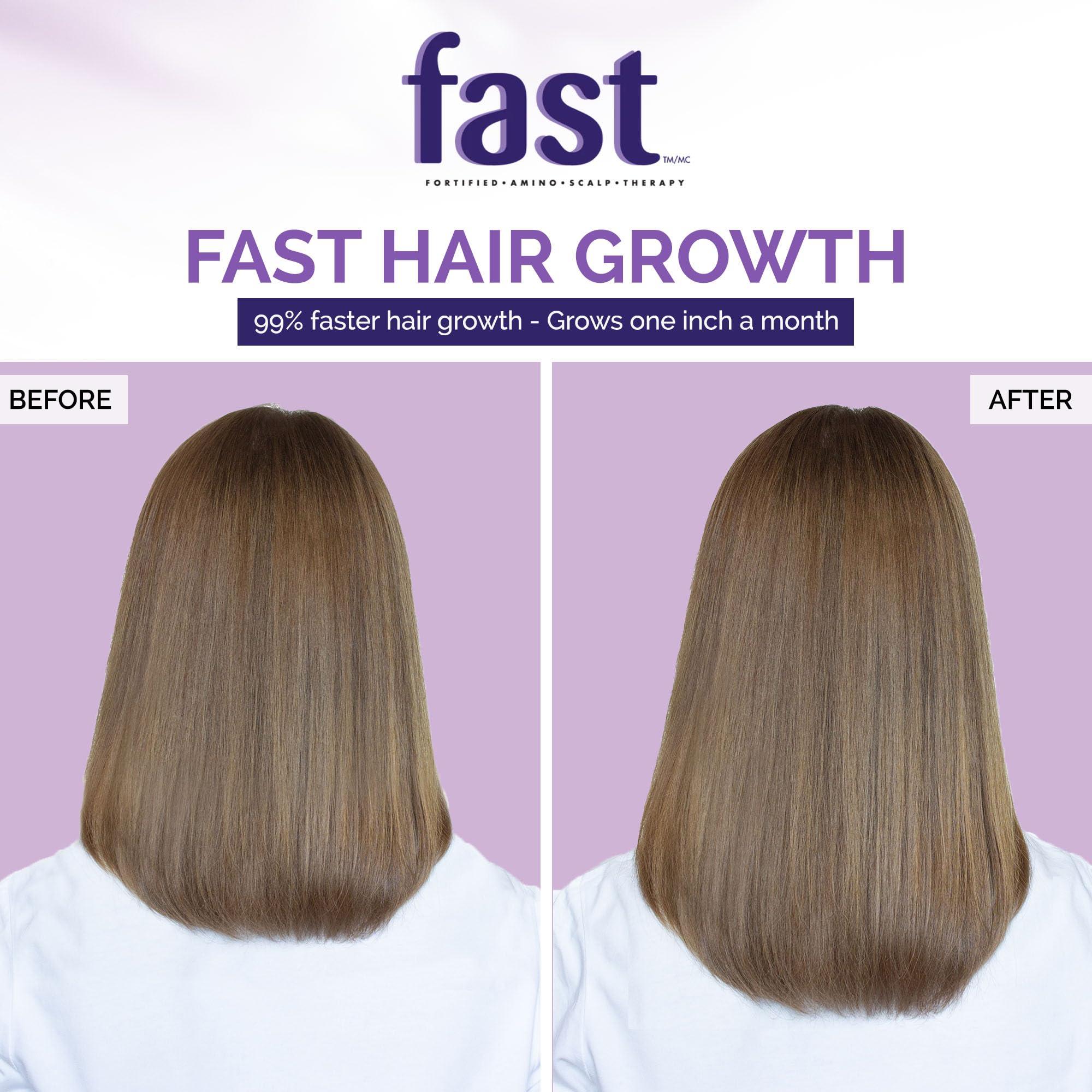 Nisim NISIM F.A.S.T Fortified Amino Scalp Therapy Shampoo & Conditioner- Promote Fast and Healthy Hair Growth (10 Ounce /300 Milliliter)