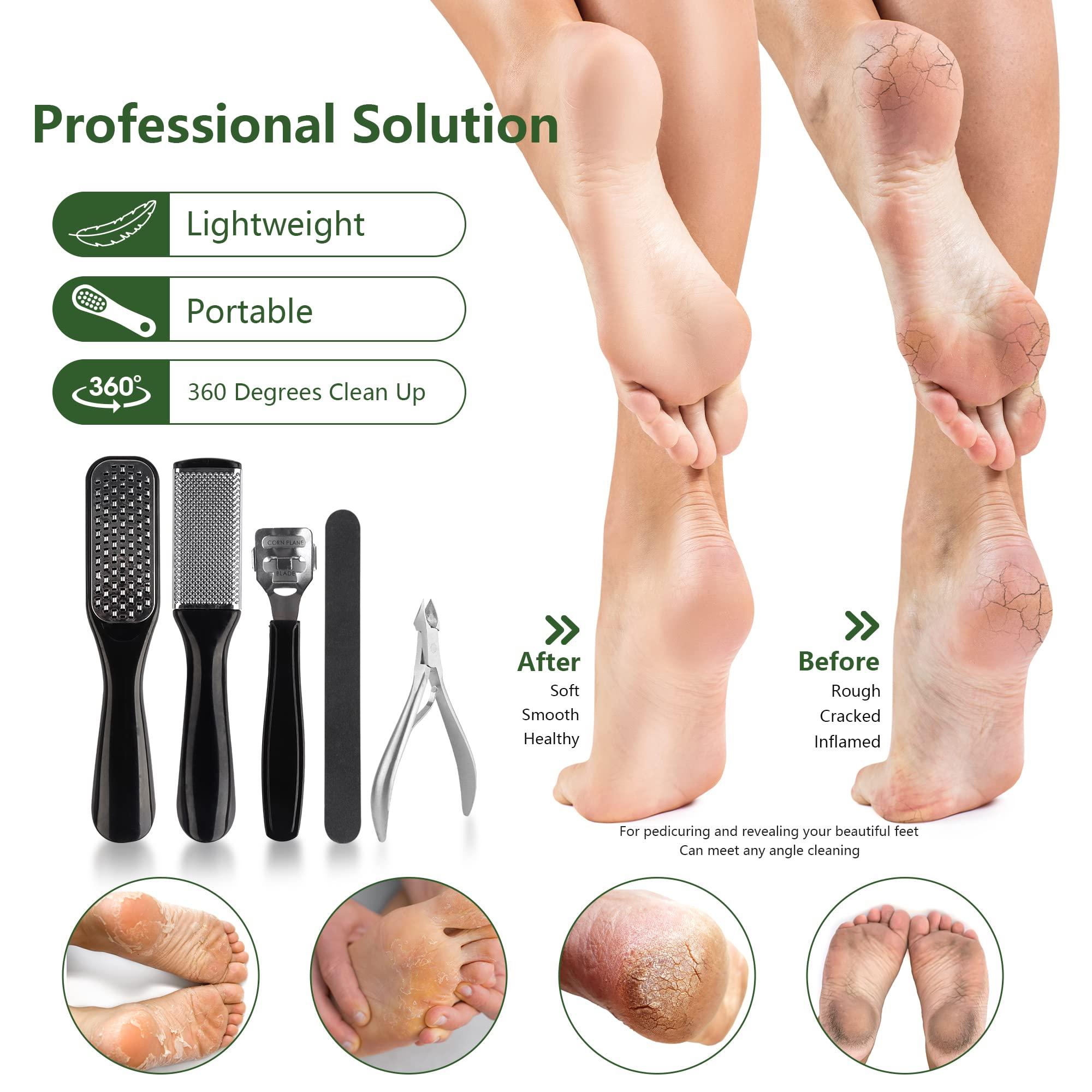 Happy Will Professional Manicure and Pedicure Tool Kit Professional Exfoliation Foot File Set for Women and Men at Home Or Travel Or Salon to Foot Care (BlackB-30PCS)