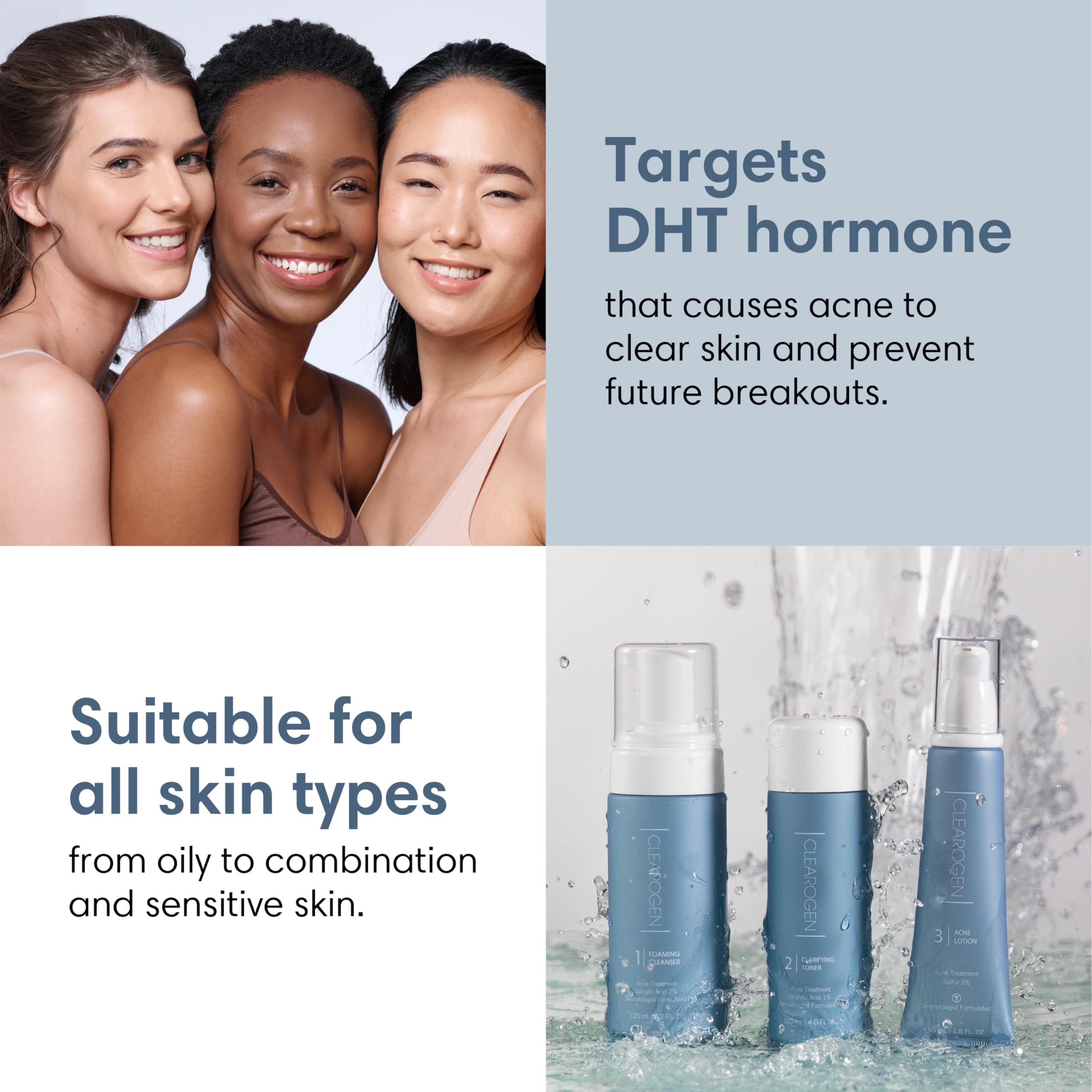 Clearogen Clearogen Hormonal Acne Solution Natural Anti-DHT Deluxe Set, 2-Month Sensitive Skin Kit