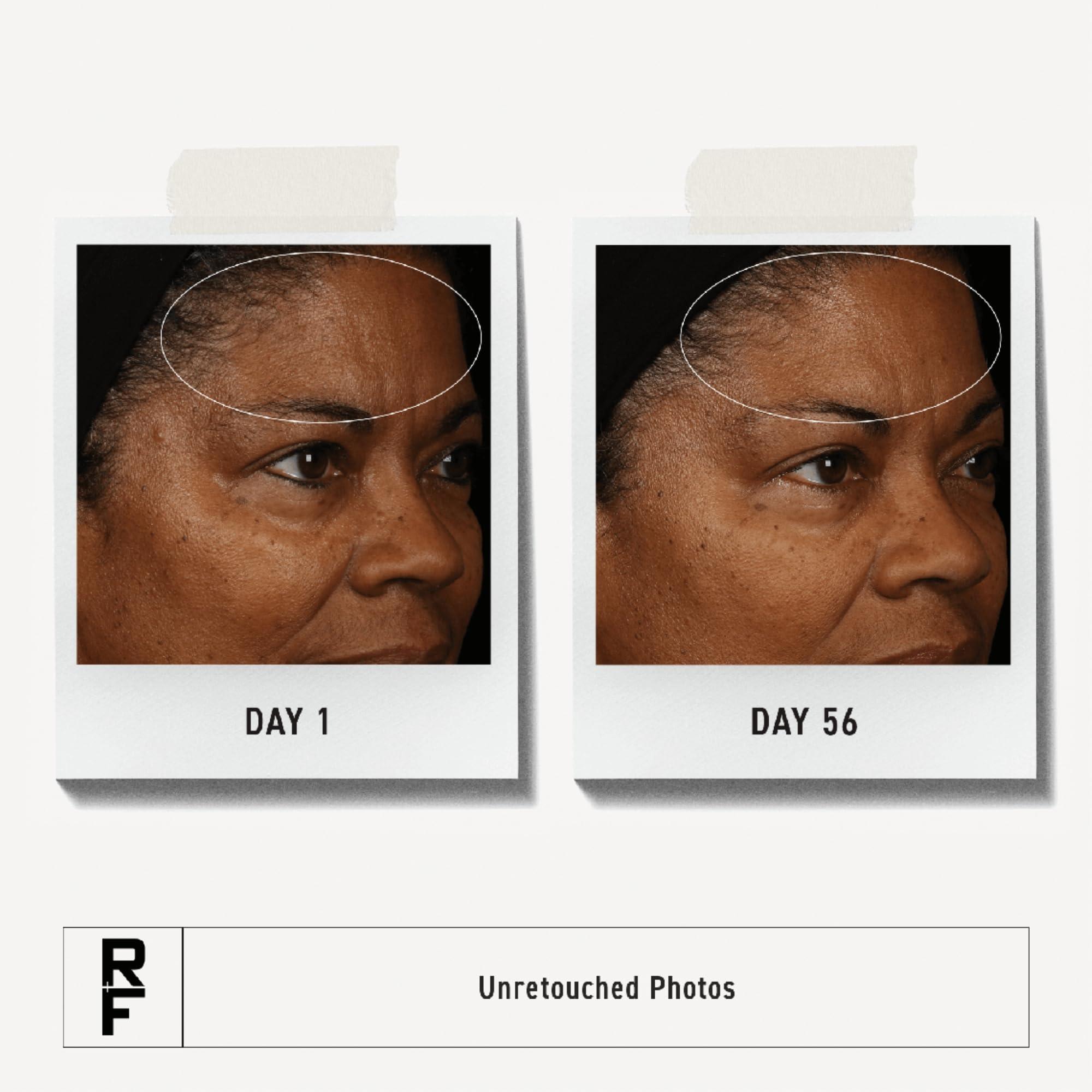 AMINZER Redefine Triple Defense Treatment,30mL/1Fl. Oz